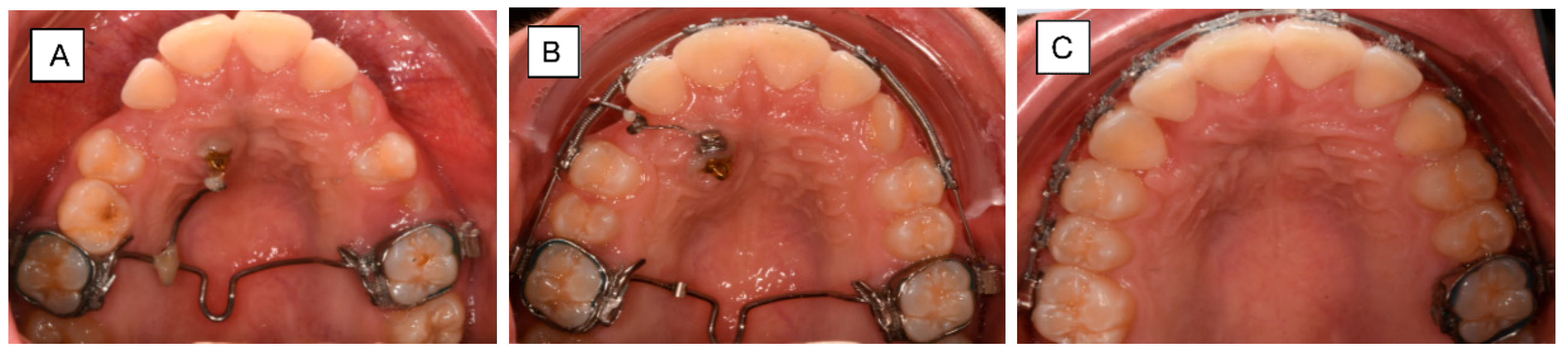 Dentistry 10 00135 g006 Dentistry 10 00135 g006