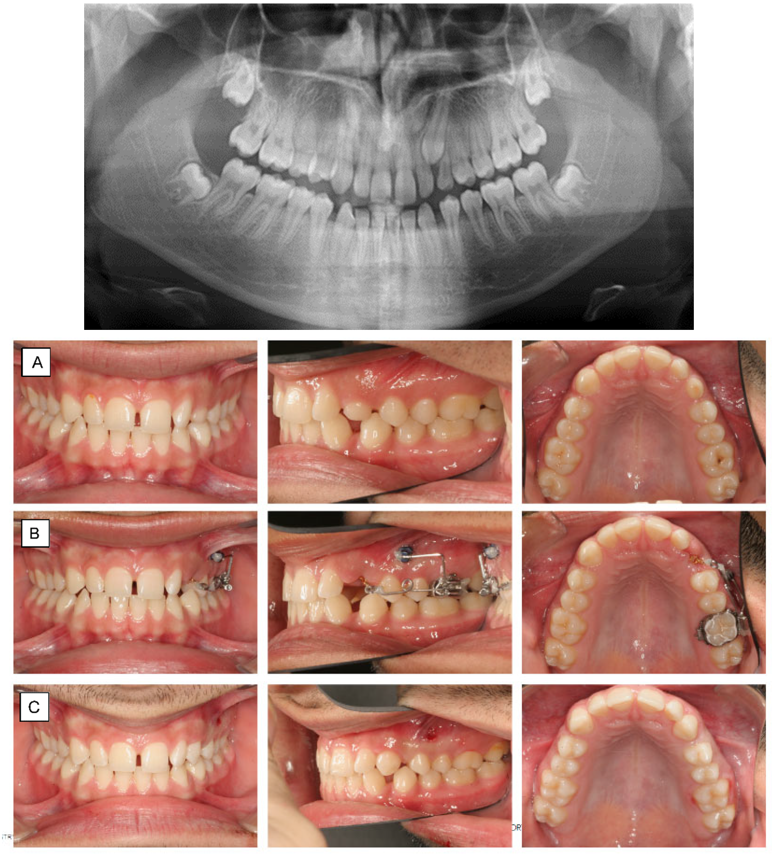 Dentistry 10 00135 g007 Dentistry 10 00135 g007