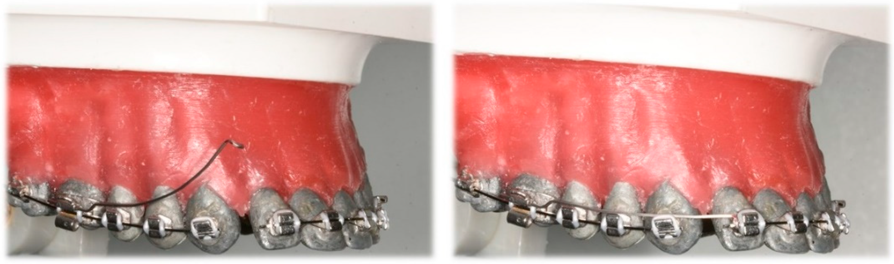 Dentistry 10 00135 g008 Dentistry 10 00135 g008