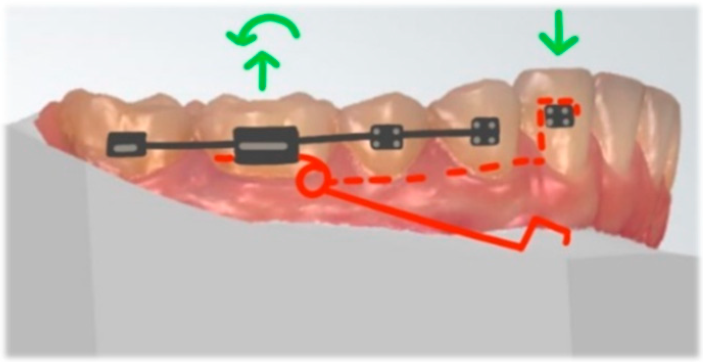 Dentistry 10 00135 g010 Dentistry 10 00135 g010
