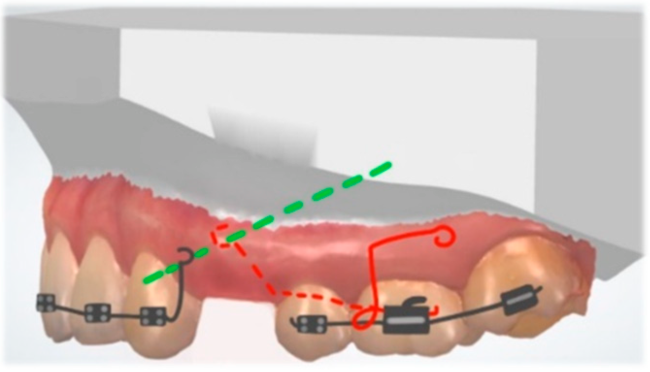 Dentistry 10 00135 g011 Dentistry 10 00135 g011
