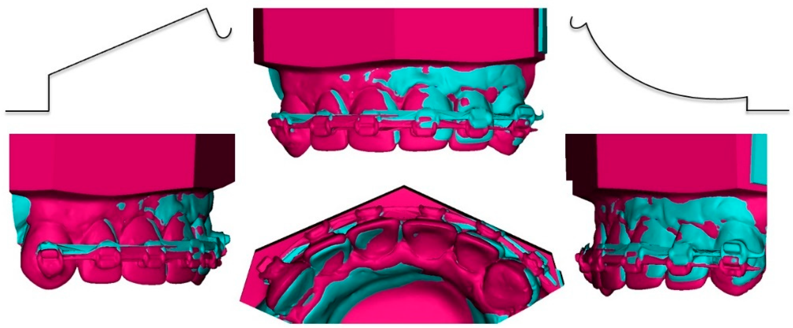 Dentistry 10 00135 g012 Dentistry 10 00135 g012