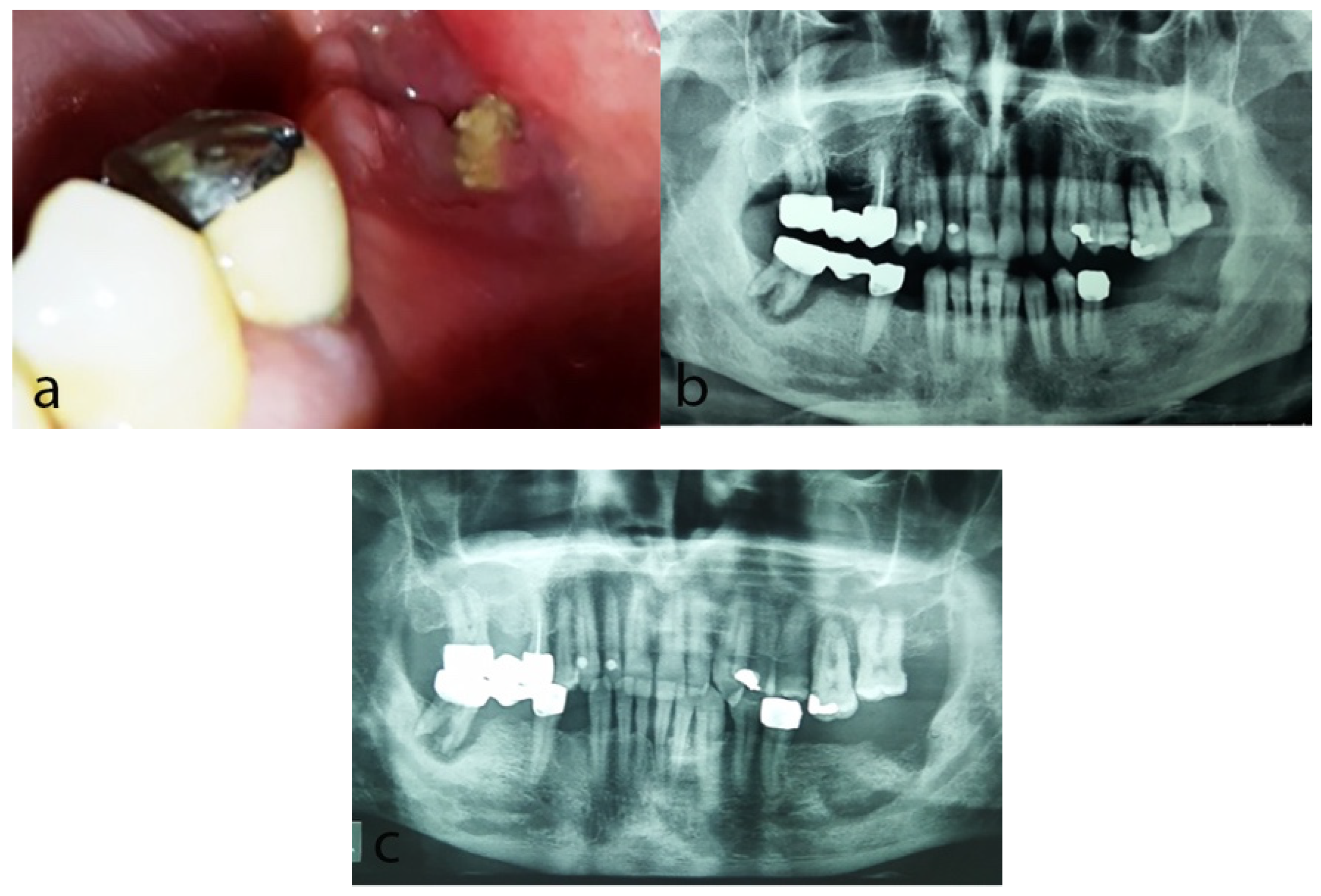 Dentistry 10 00232 g002 Dentistry 10 00232 g002