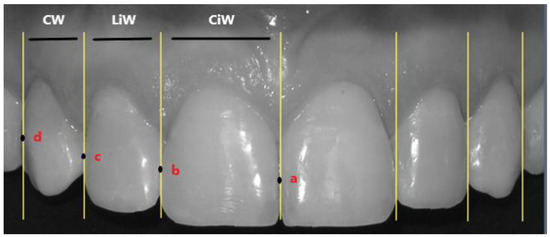 Comparison of Two Scales For Evaluation of Smile and Dental Attractiveness, PDF, Orthodontics