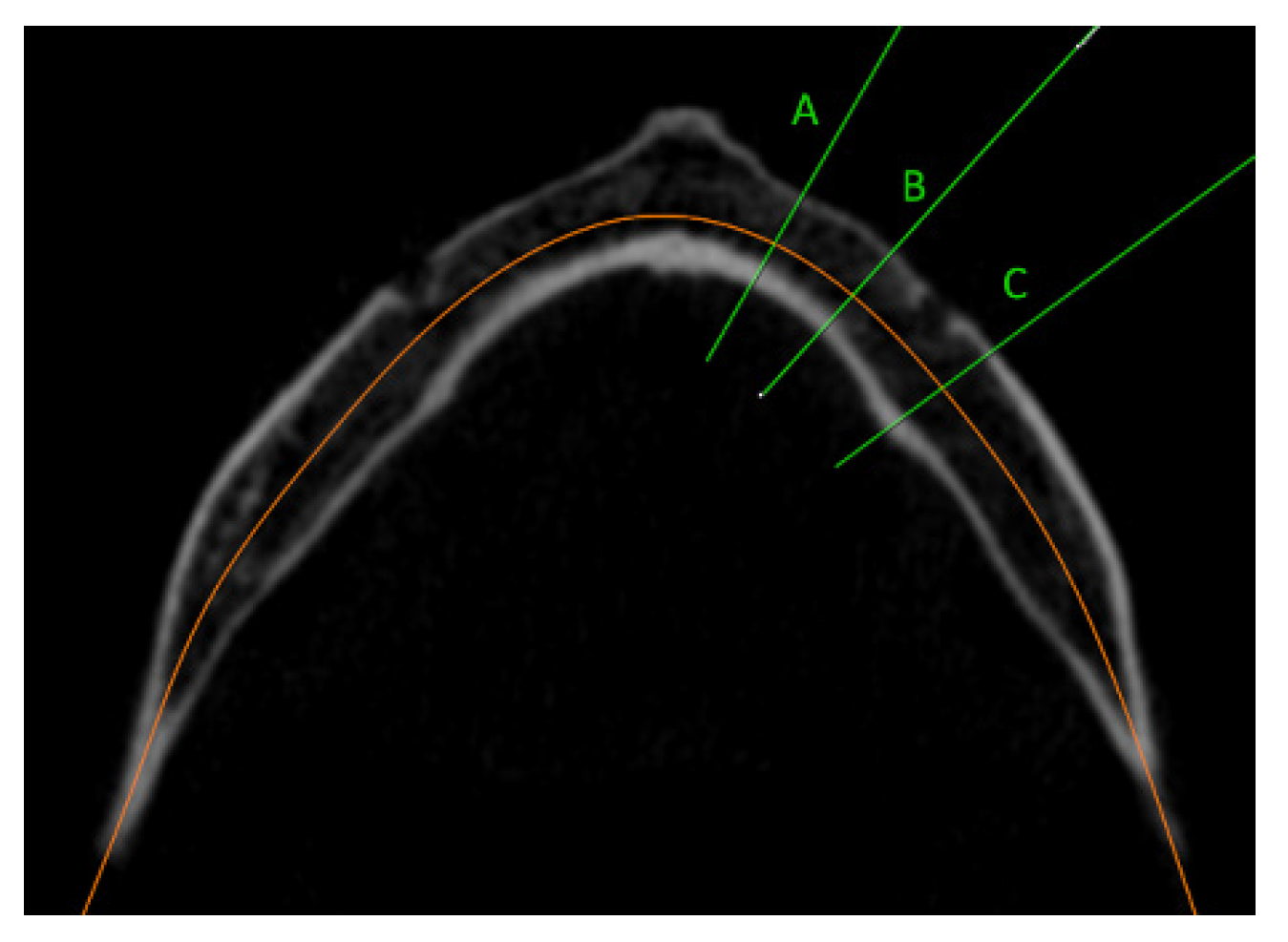 Dentistry 11 00017 g001 Dentistry 11 00017 g001