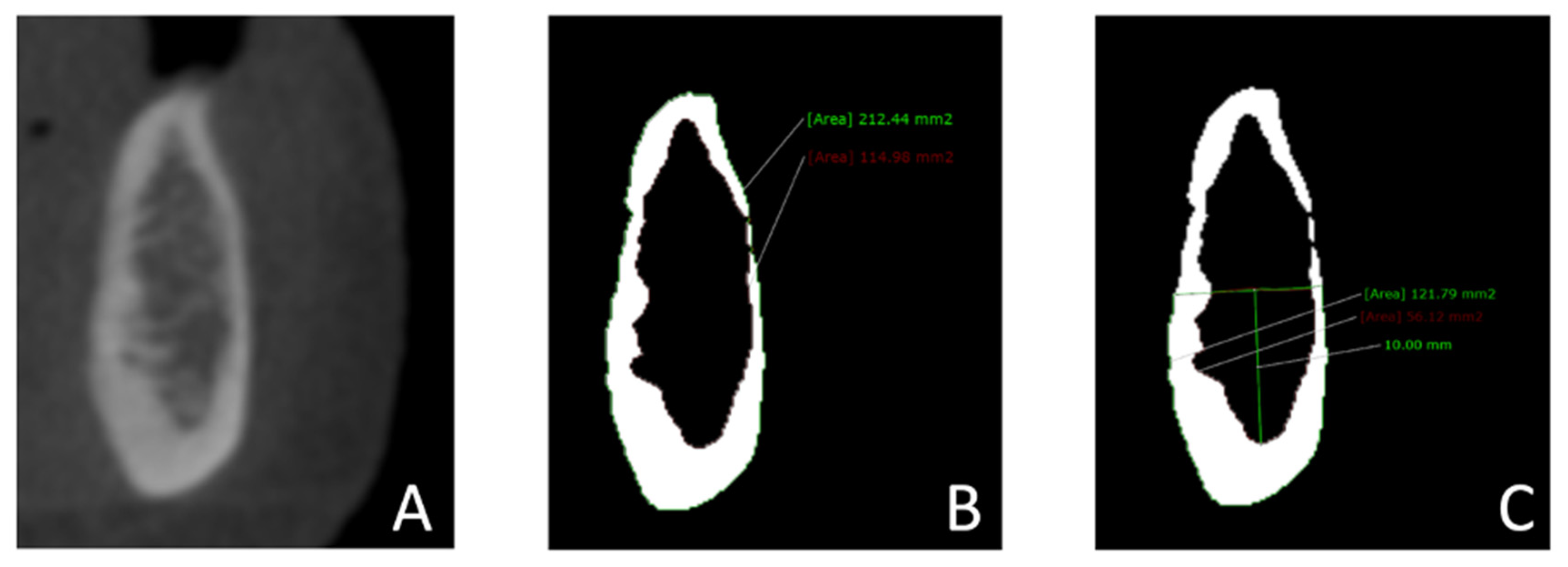 Dentistry 11 00017 g002 Dentistry 11 00017 g002