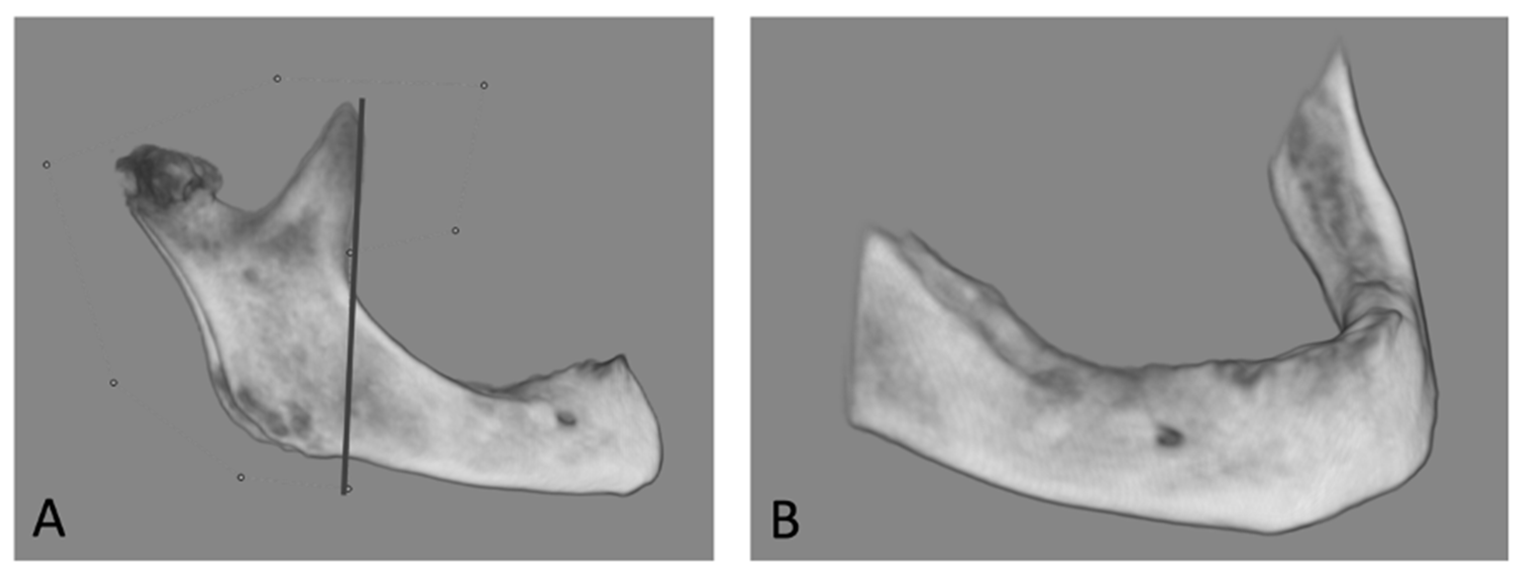 Dentistry 11 00017 g003 Dentistry 11 00017 g003