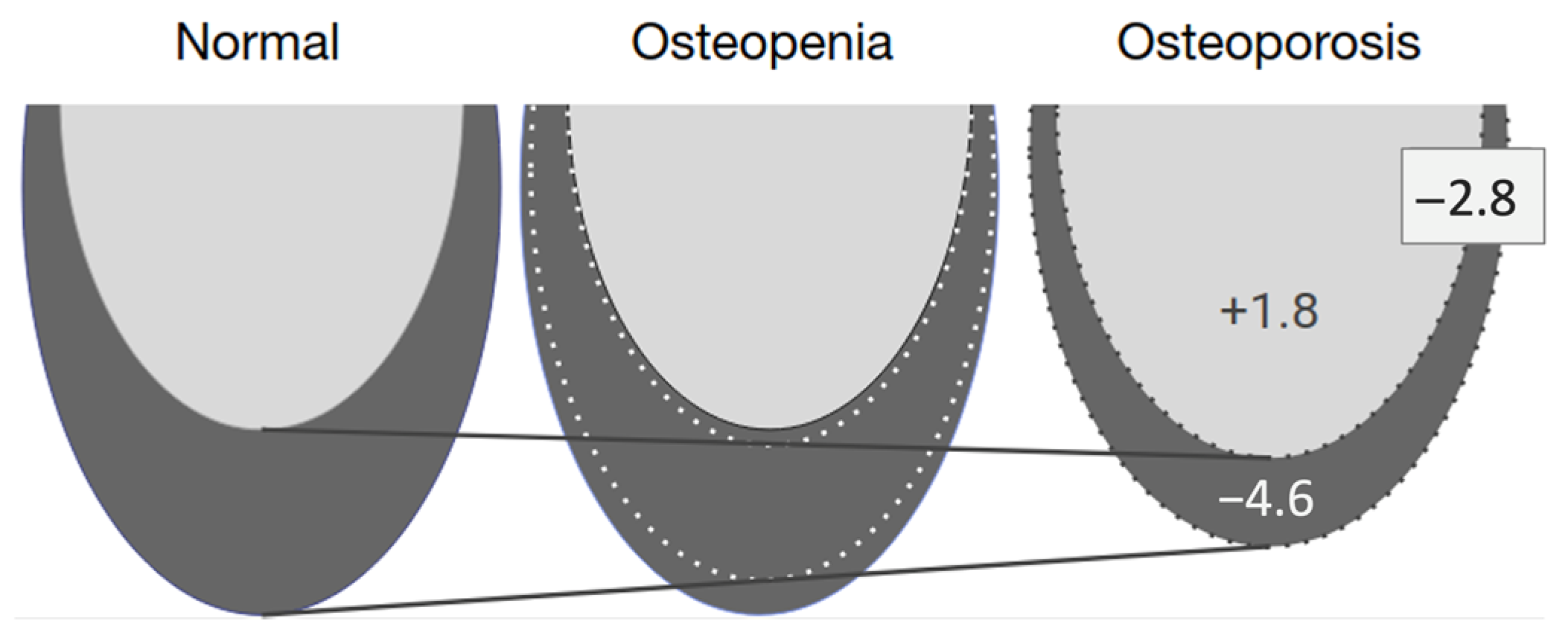 Dentistry 11 00017 g006 Dentistry 11 00017 g006