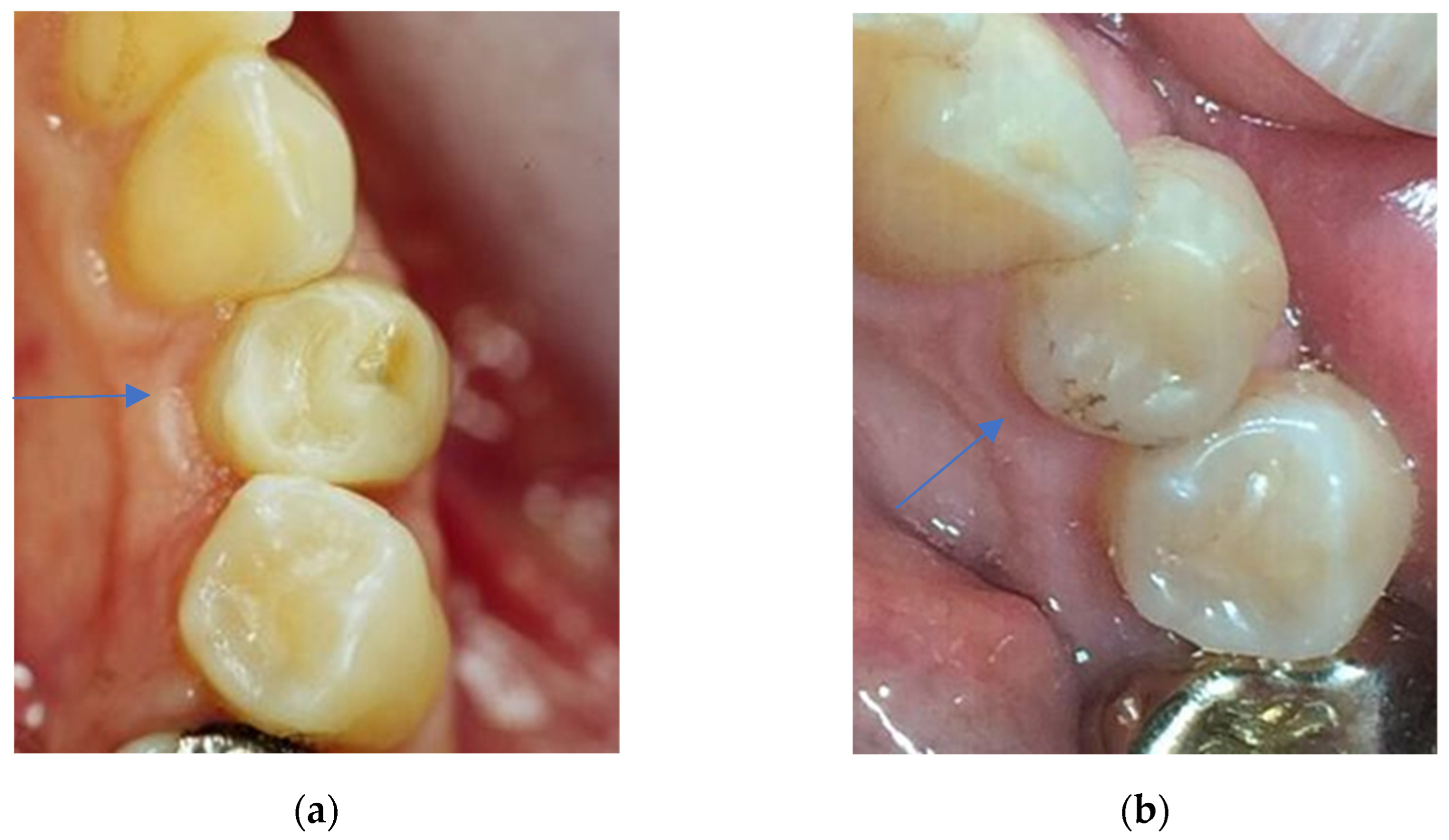 Dentistry 11 00069 g005 Dentistry 11 00069 g005