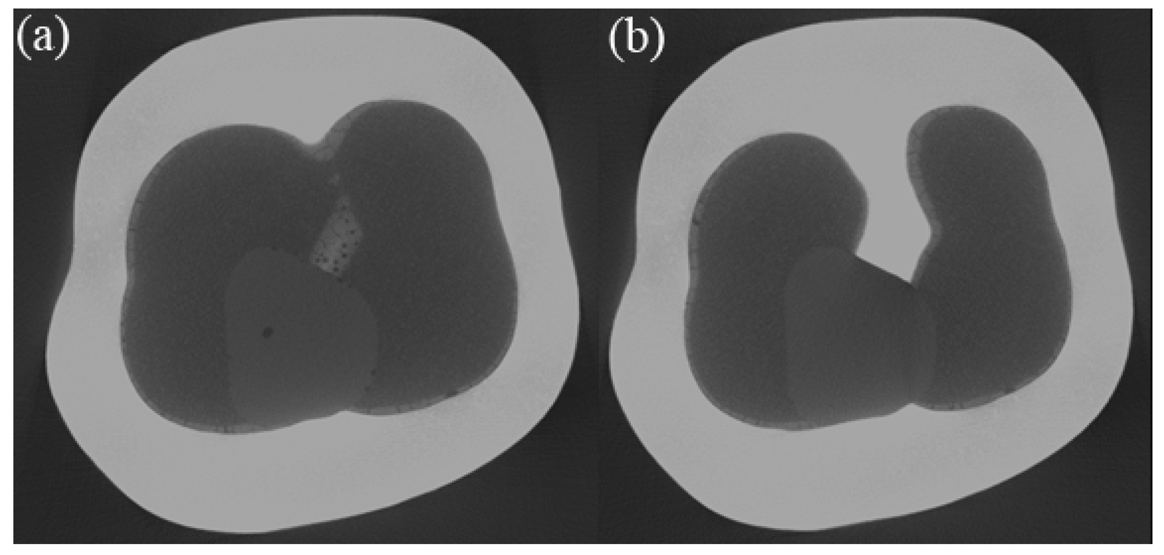 Dentistry 11 00076 g005 Dentistry 11 00076 g005