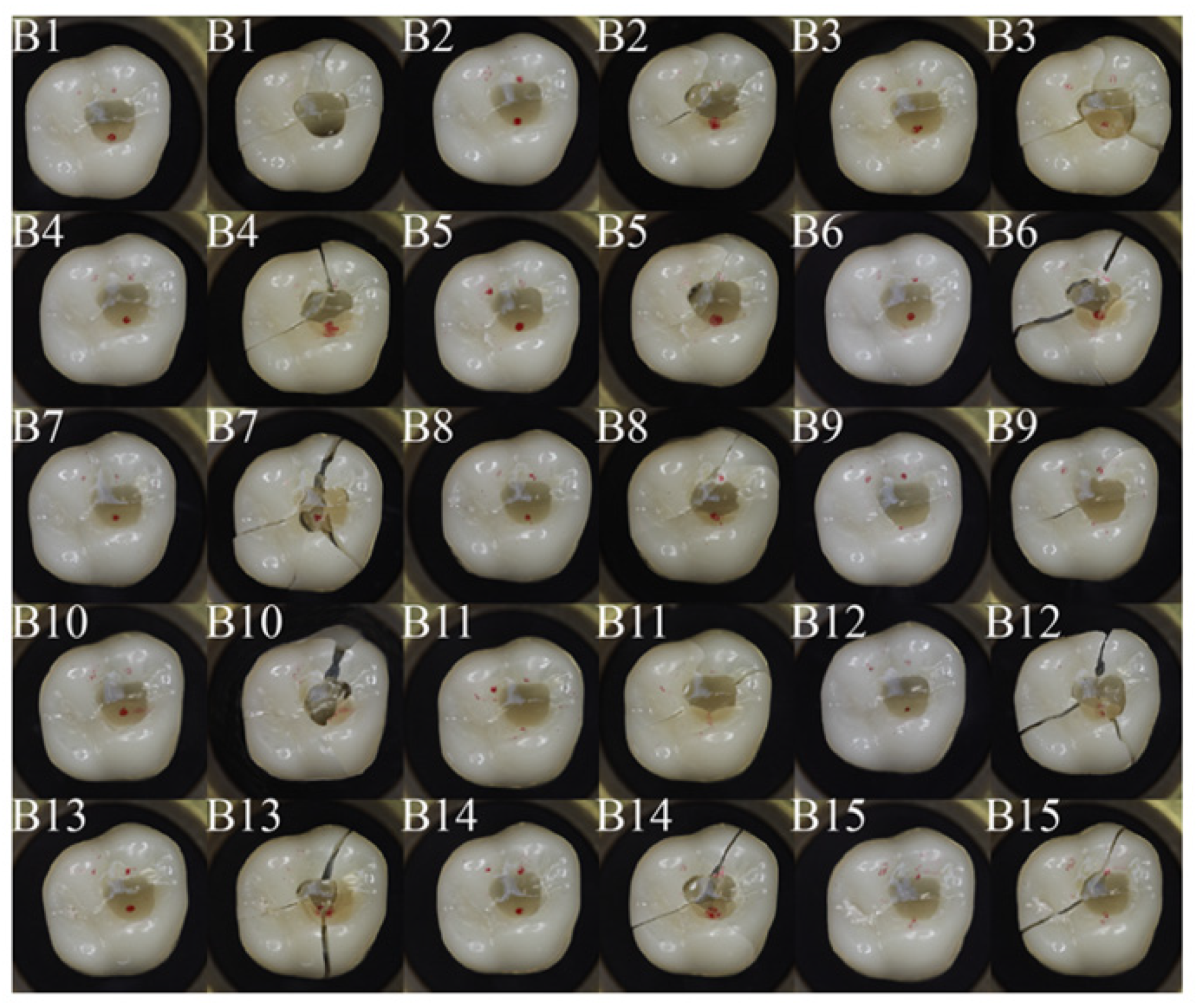 Dentistry 11 00076 g006 Dentistry 11 00076 g006