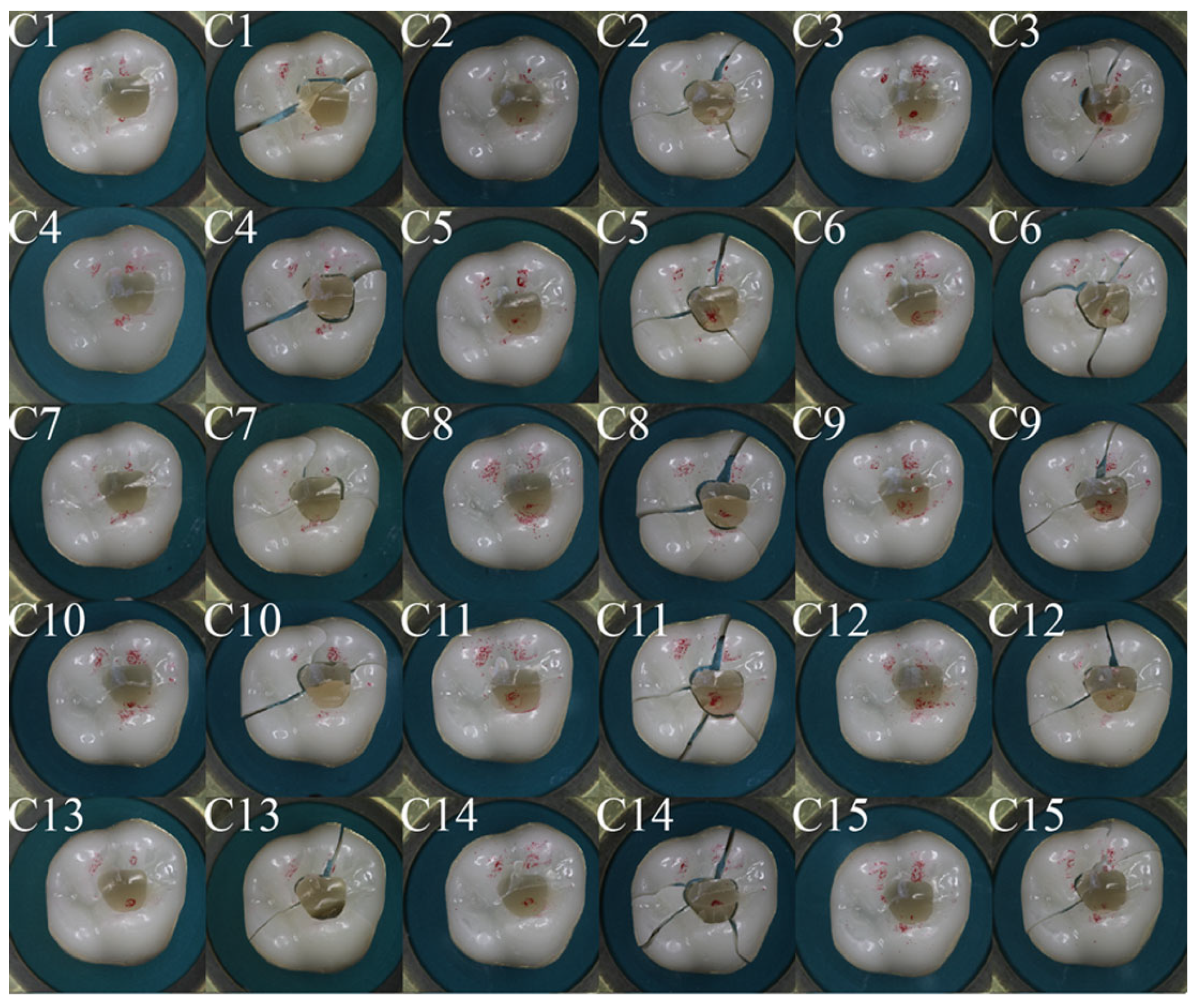 Dentistry 11 00076 g007 Dentistry 11 00076 g007