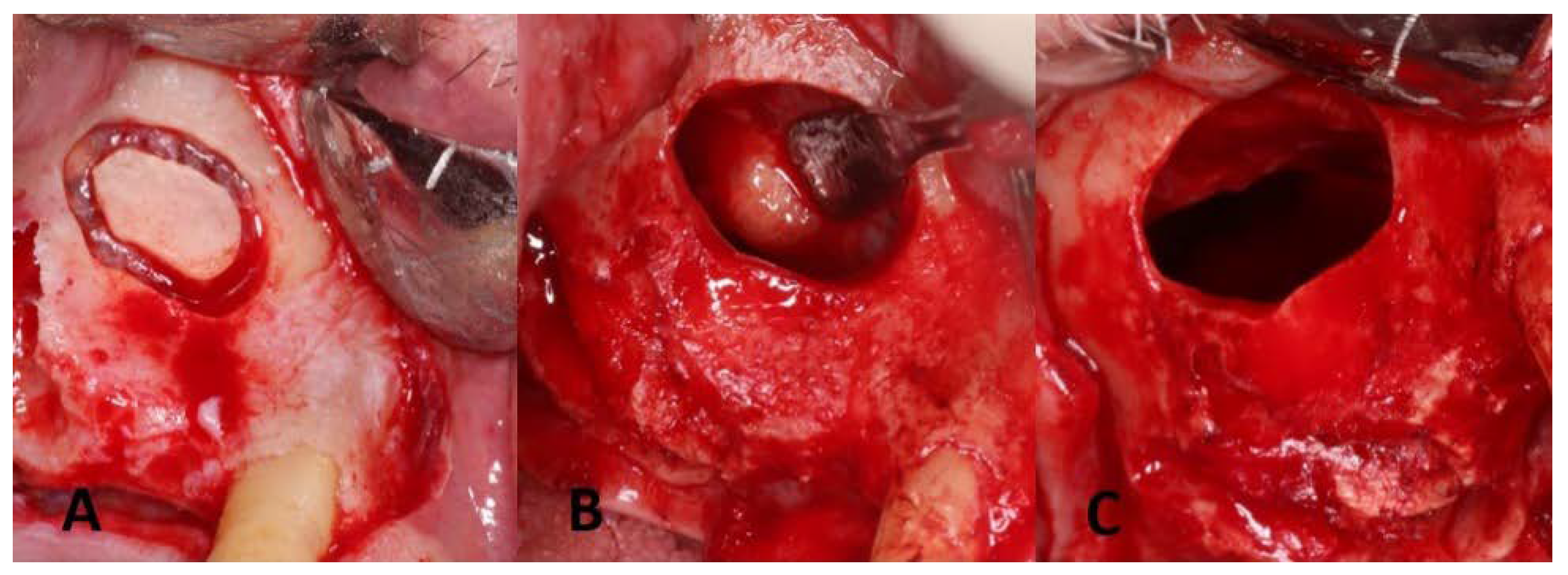 Dentistry 11 00084 g003 Dentistry 11 00084 g003