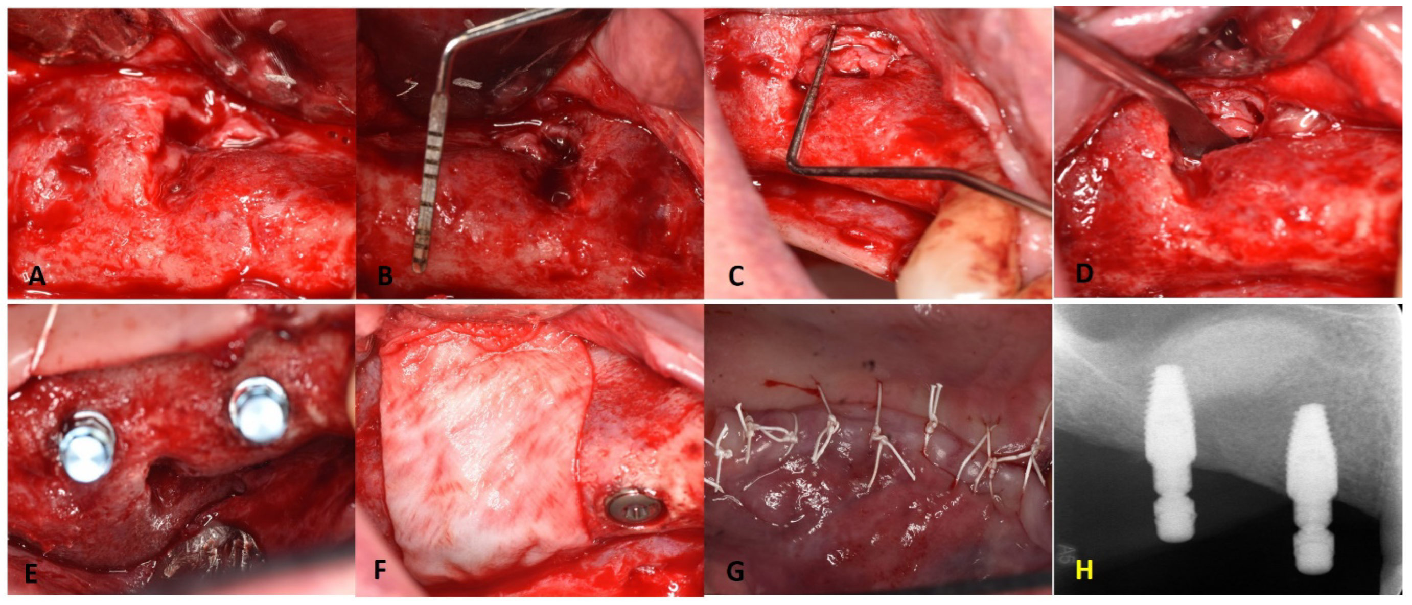 Dentistry 11 00084 g006 Dentistry 11 00084 g006