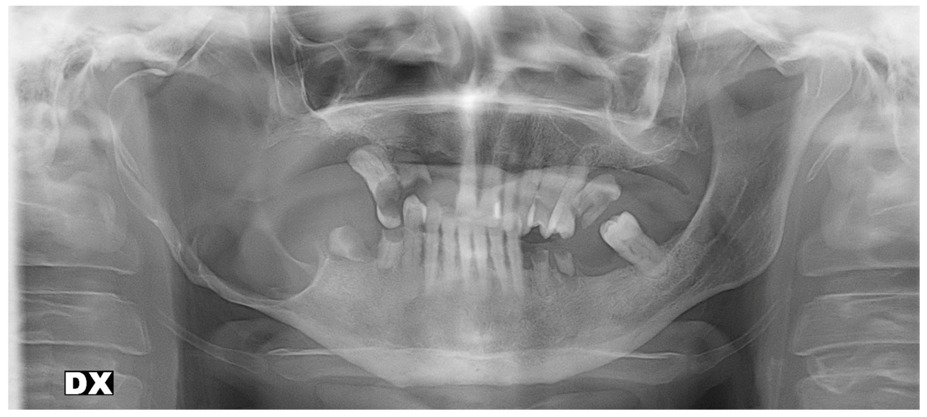 Dentistry 11 00106 g002 Dentistry 11 00106 g002