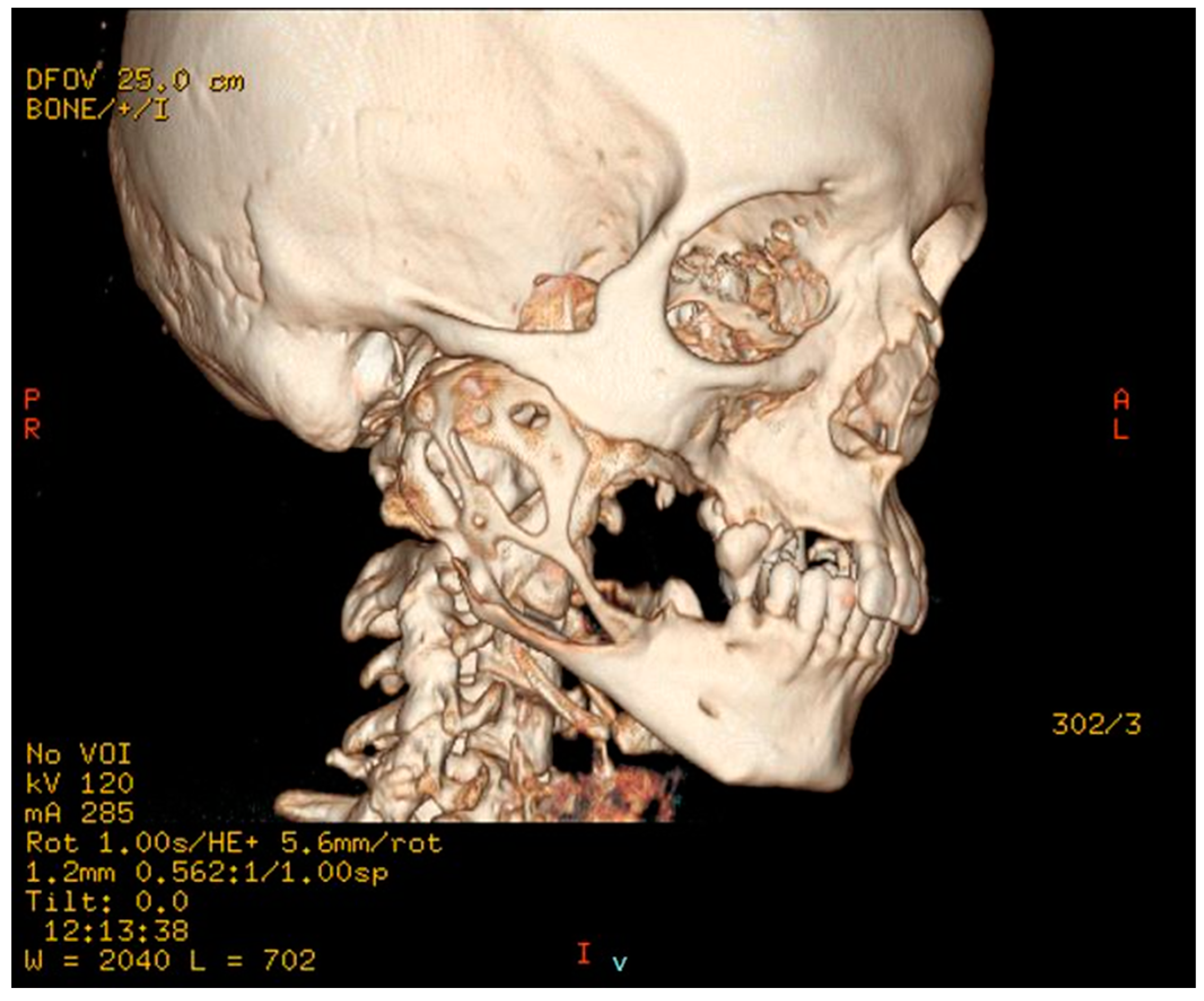 Dentistry 11 00106 g003 Dentistry 11 00106 g003