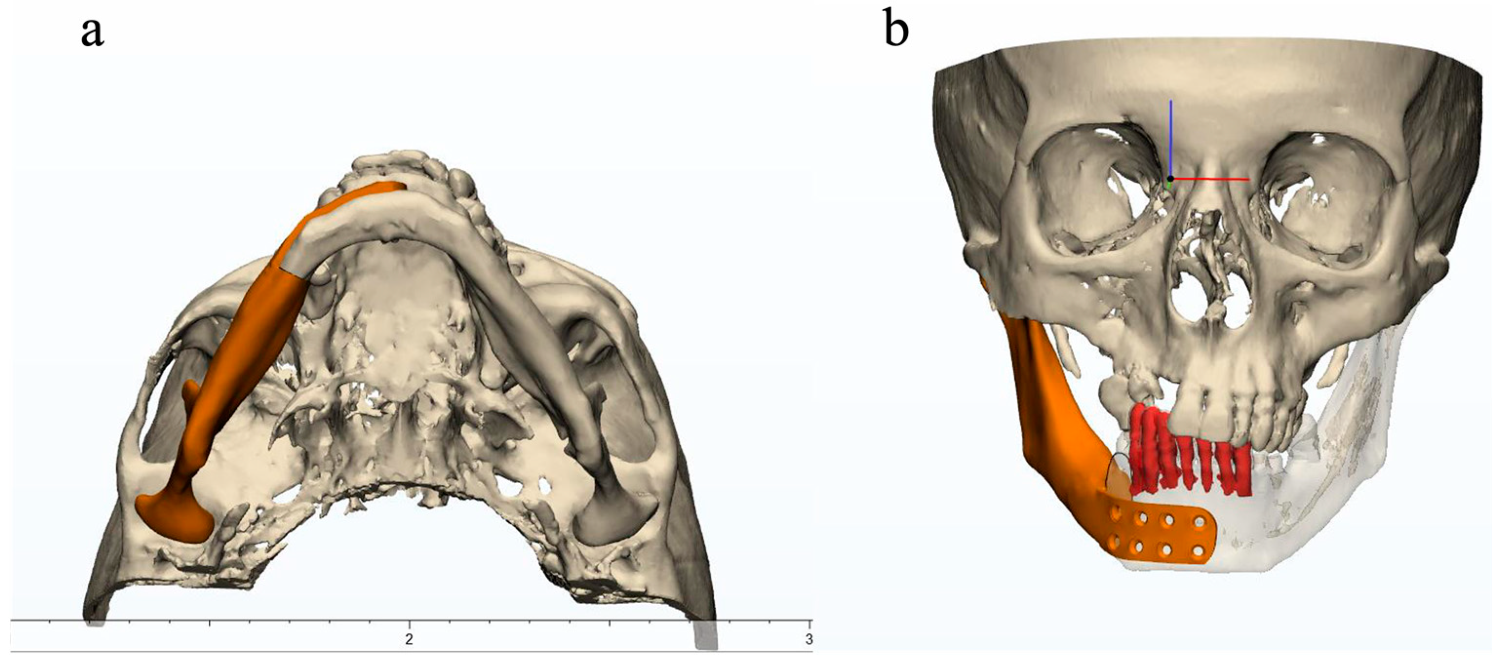 Dentistry 11 00106 g004 Dentistry 11 00106 g004