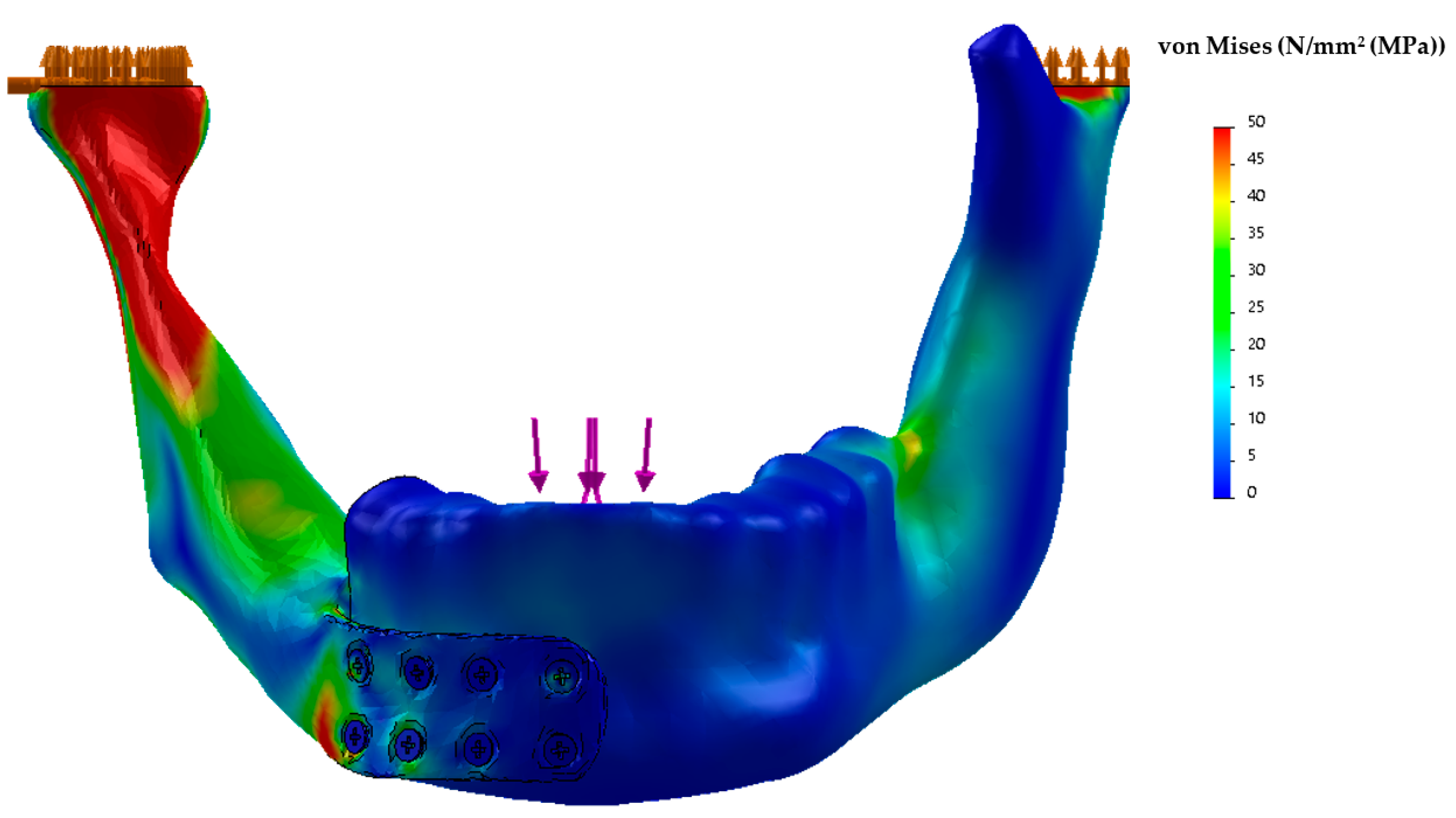 Dentistry 11 00106 g006 Dentistry 11 00106 g006