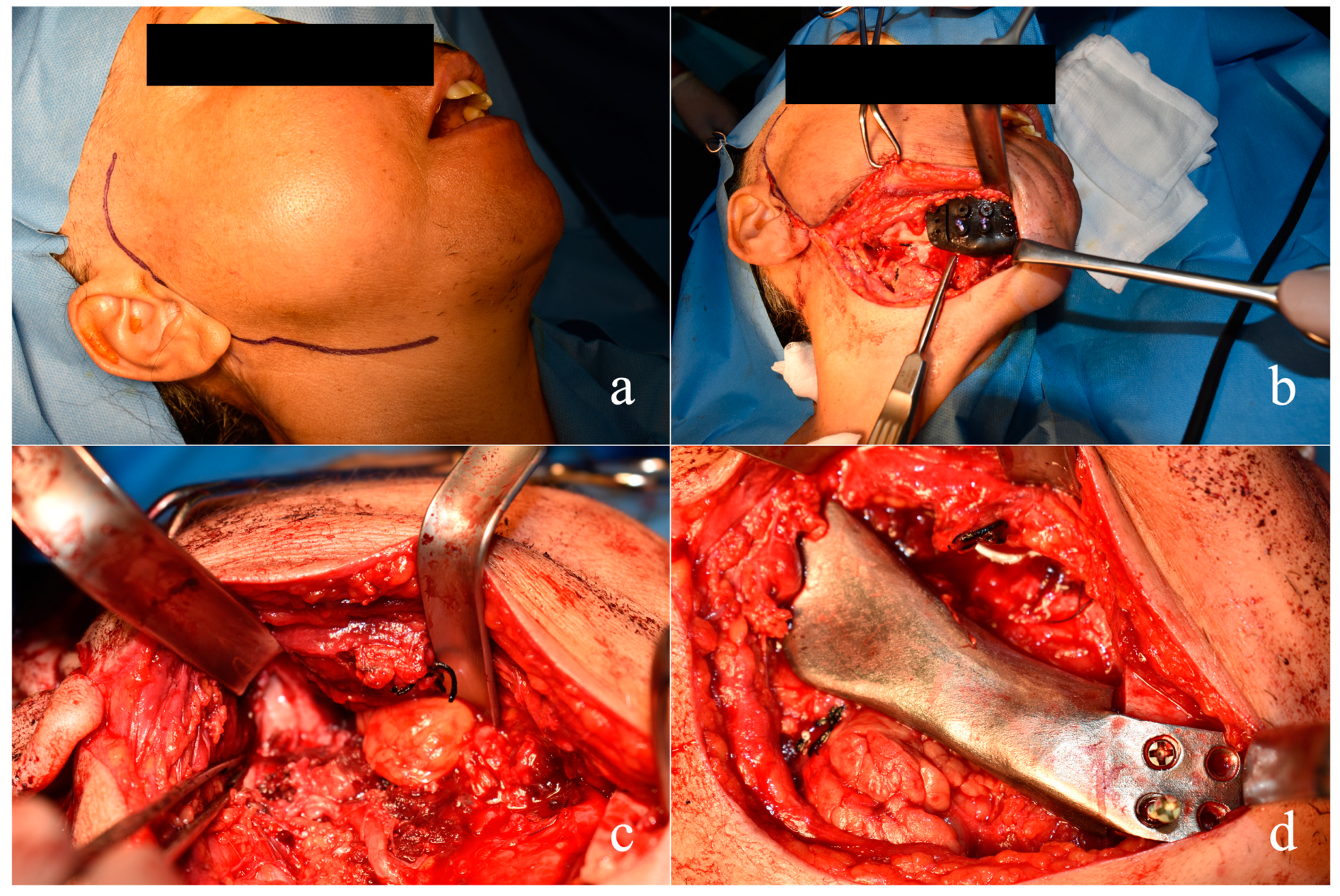 Dentistry 11 00106 g007 Dentistry 11 00106 g007