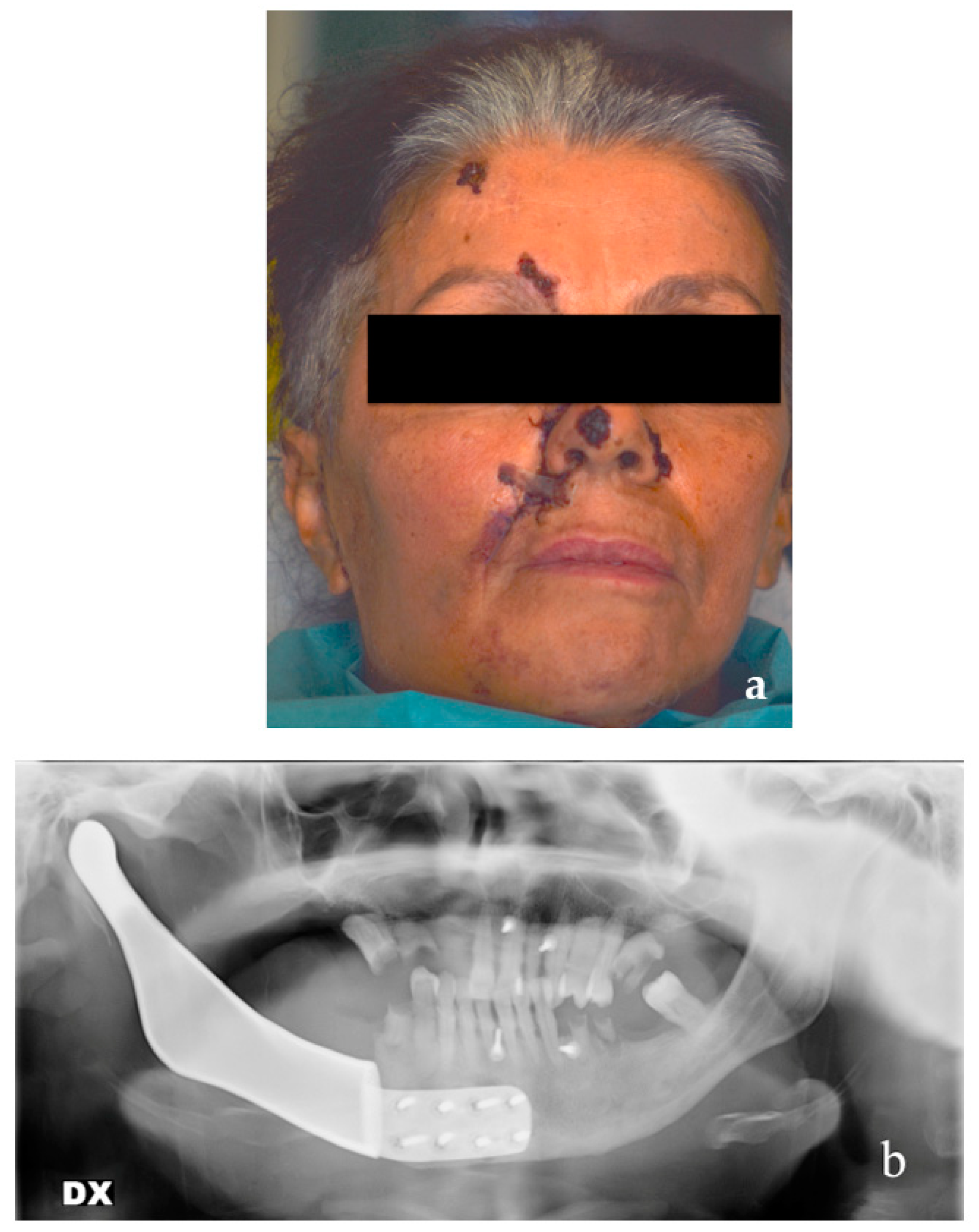 Dentistry 11 00106 g008 Dentistry 11 00106 g008