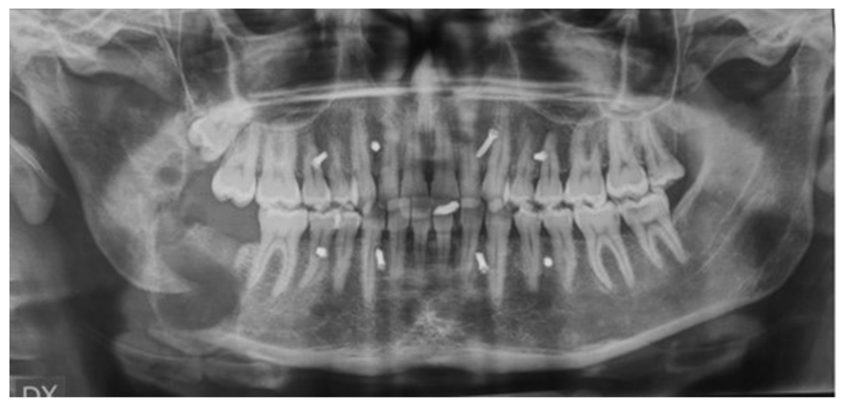 Dentistry 11 00106 g009 Dentistry 11 00106 g009