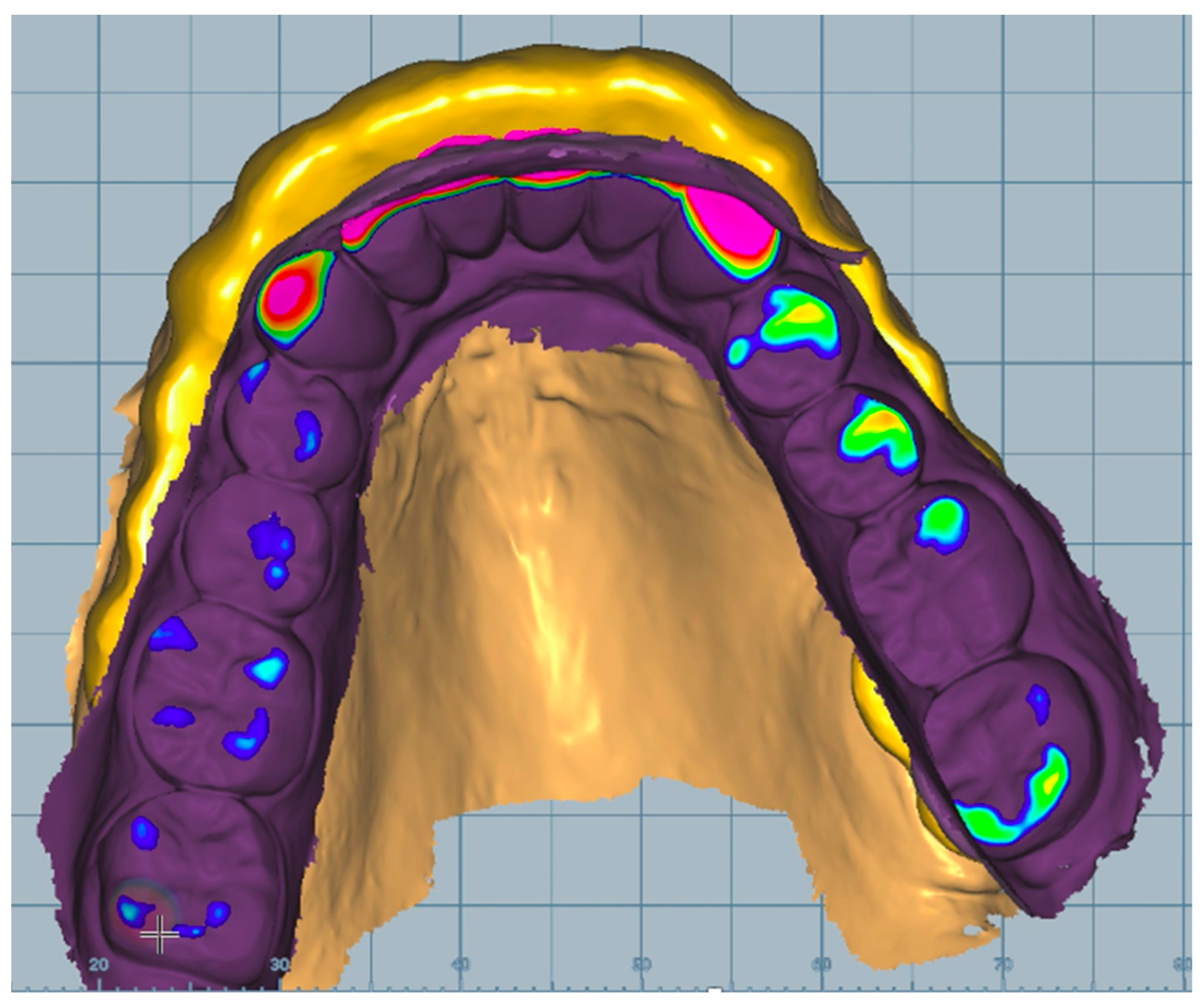 Dentistry 11 00126 g004 Dentistry 11 00126 g004