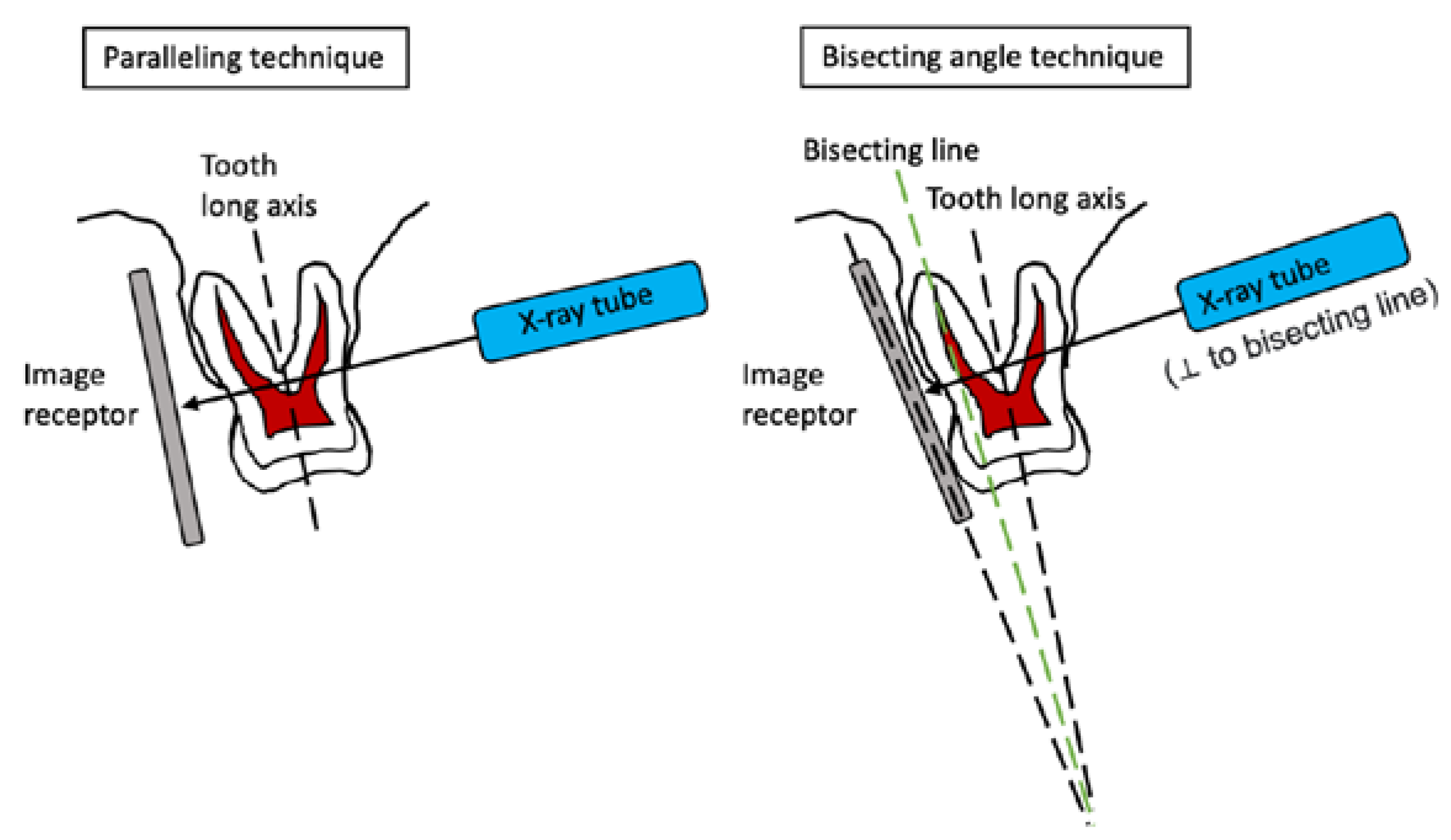 Dentistry Journal Free FullText The Performance of Paralleling