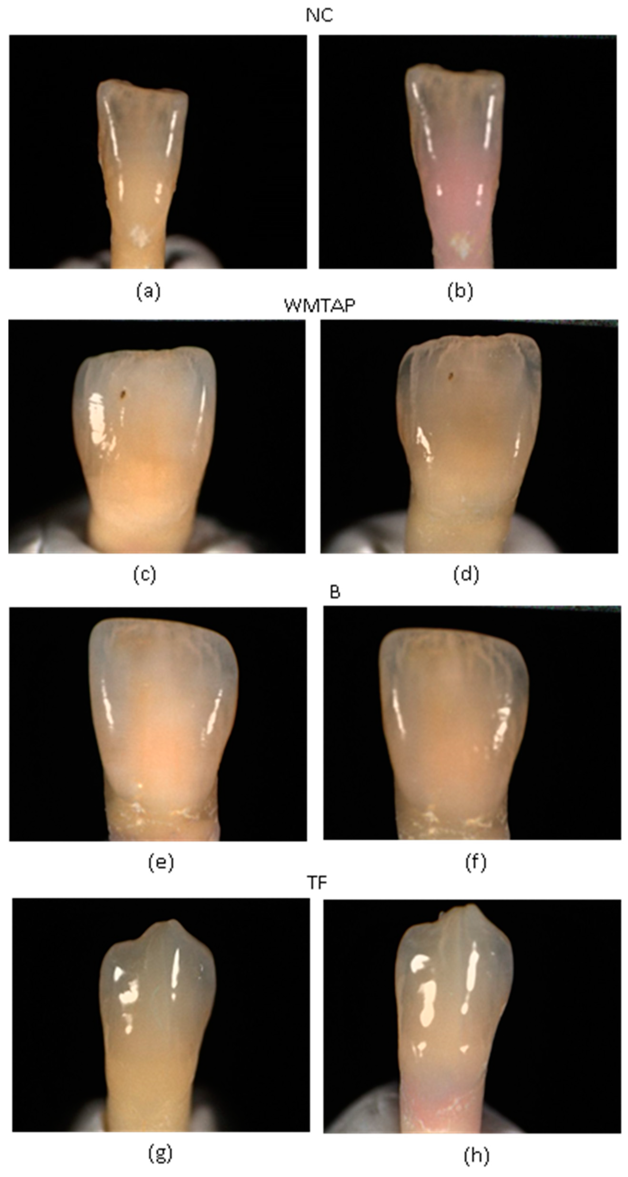 Dentistry 11 00180 g001 Dentistry 11 00180 g001