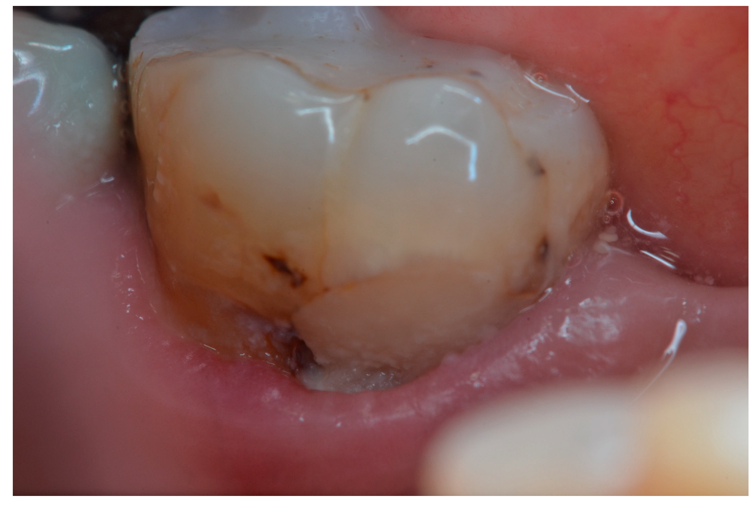 Dentistry 11 00225 g004