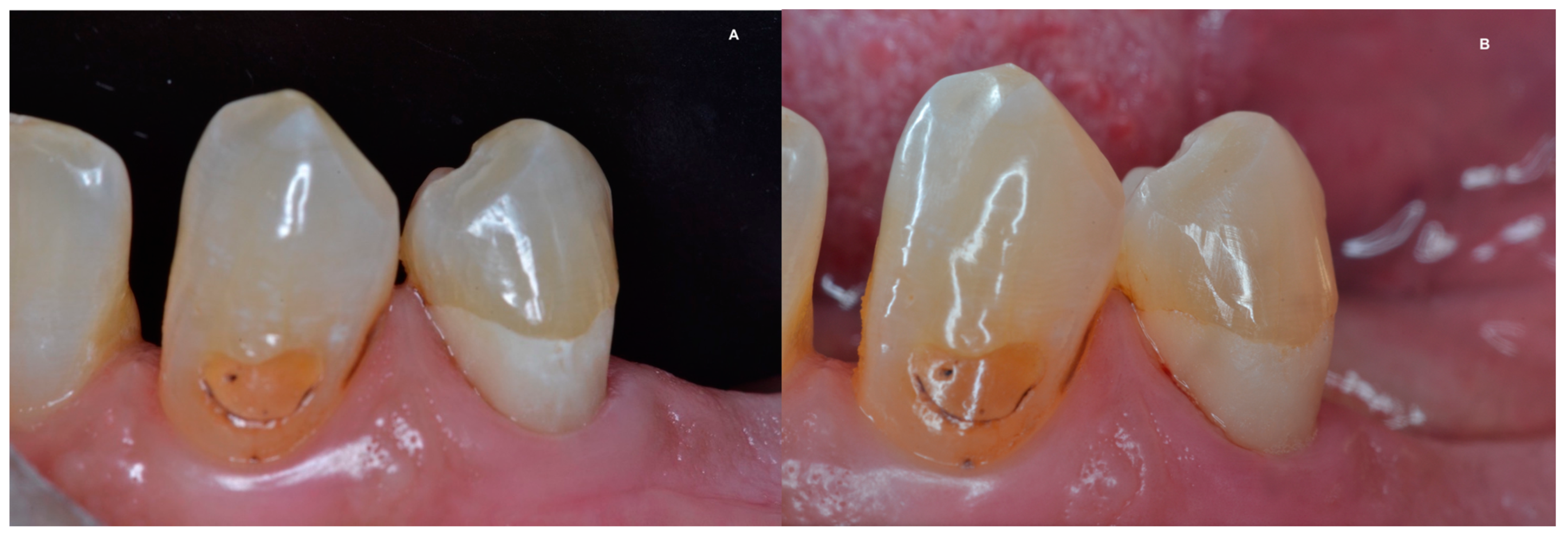 Dentistry 11 00225 g005