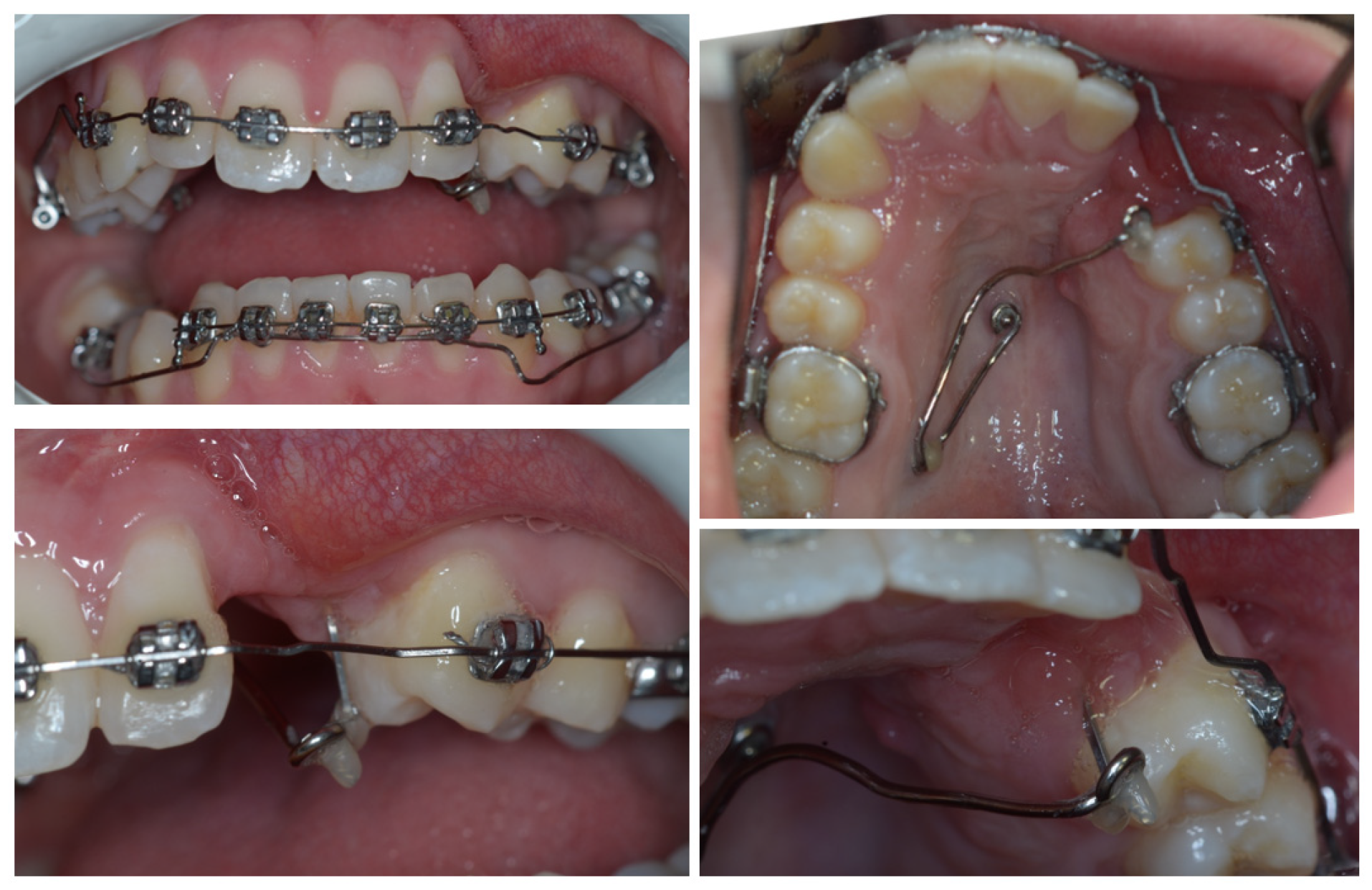 Dentistry 11 00278 g010 Dentistry 11 00278 g010