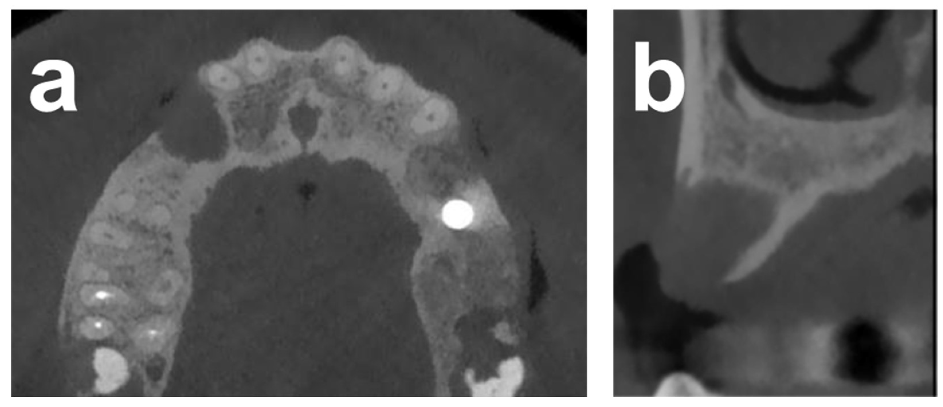 Dentistry 12 00042 g004