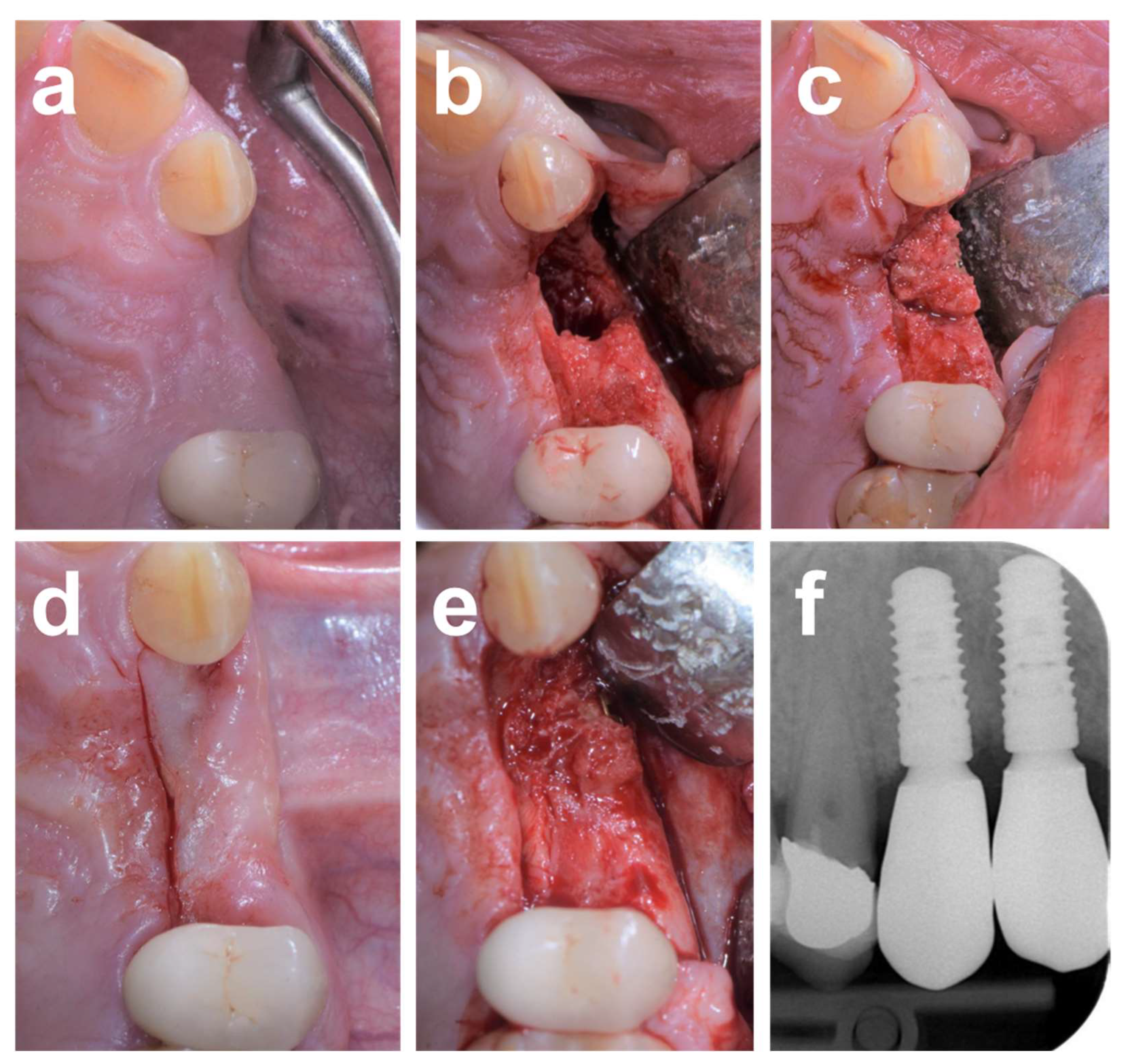 Dentistry 12 00042 g005