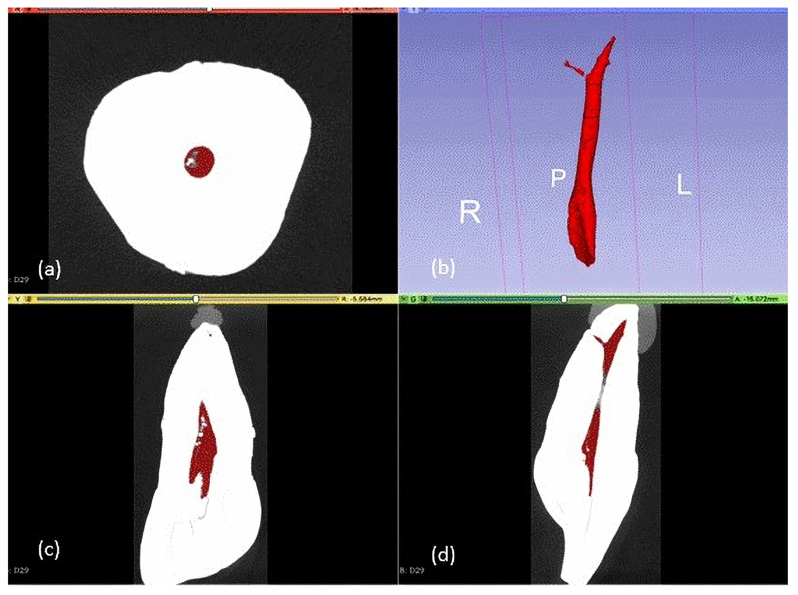 Dentistry 12 00095 g002 Dentistry 12 00095 g002