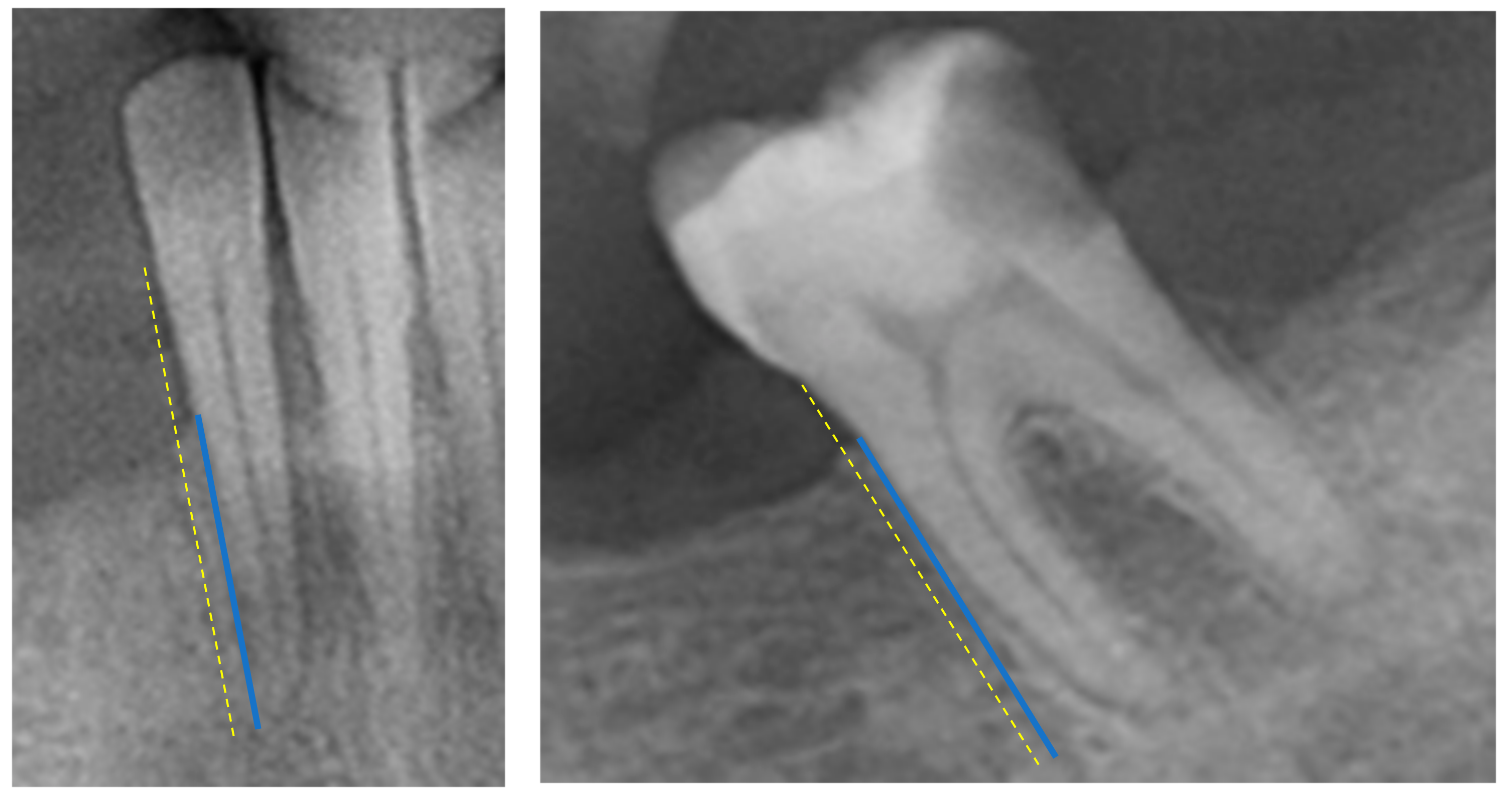 Dentistry Journal | Free Full-Text | Analyzing Oral Health Conditions in Sex  Workers—A Comparative Retrospective Clinical and Radiographic Study