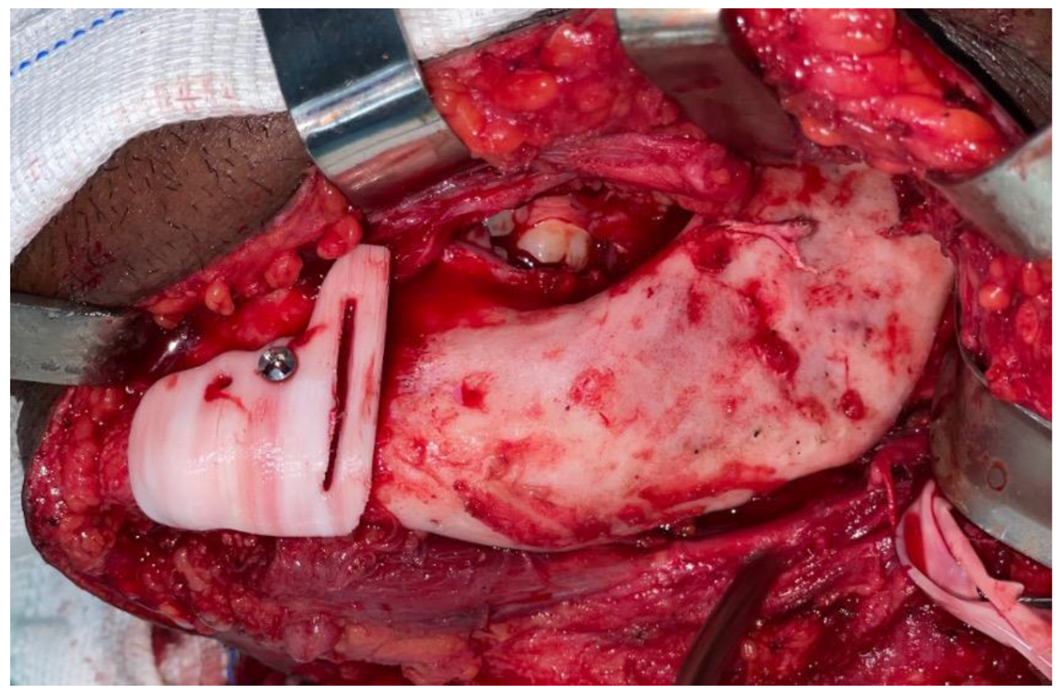 Dentistry 12 00192 g007