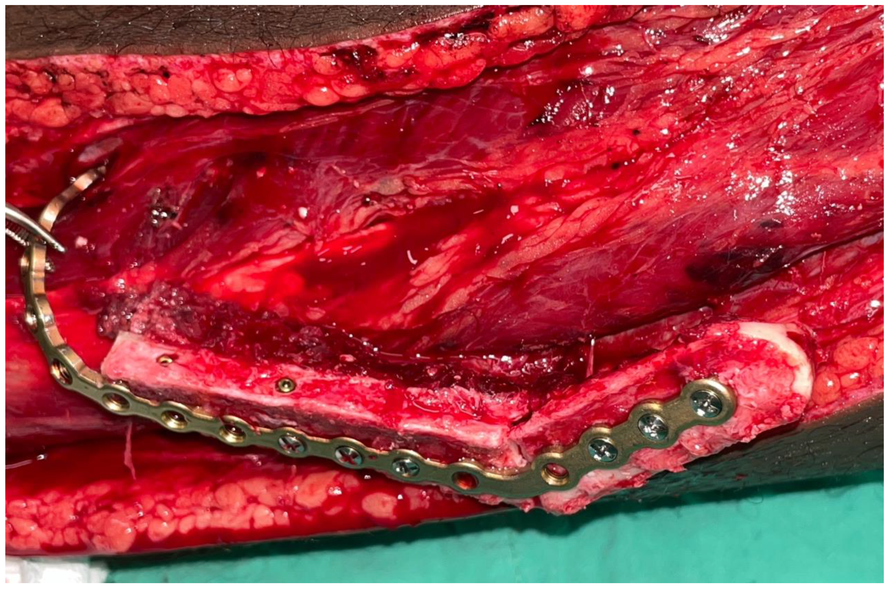 Dentistry 12 00192 g010