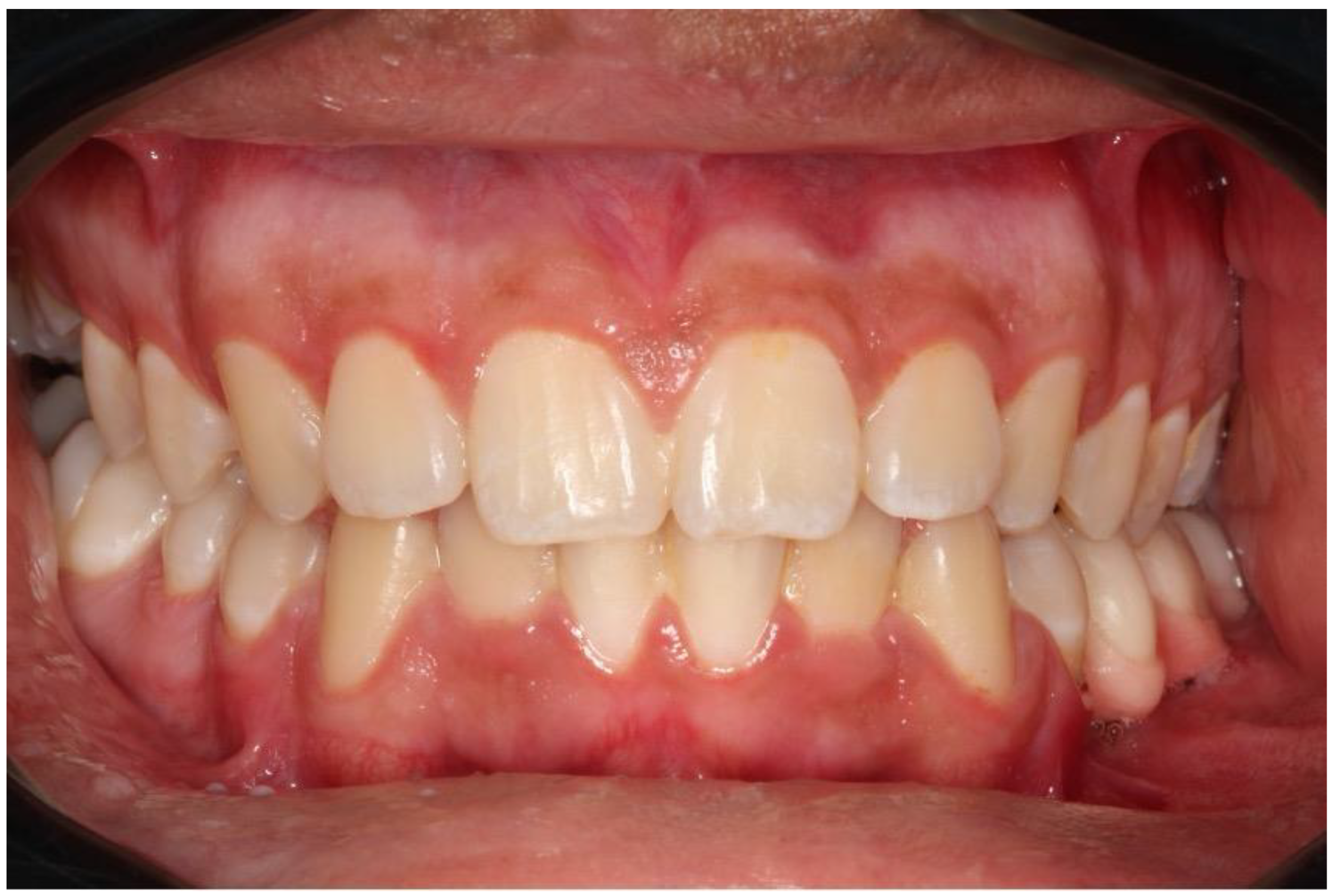 Dentistry 12 00192 g013