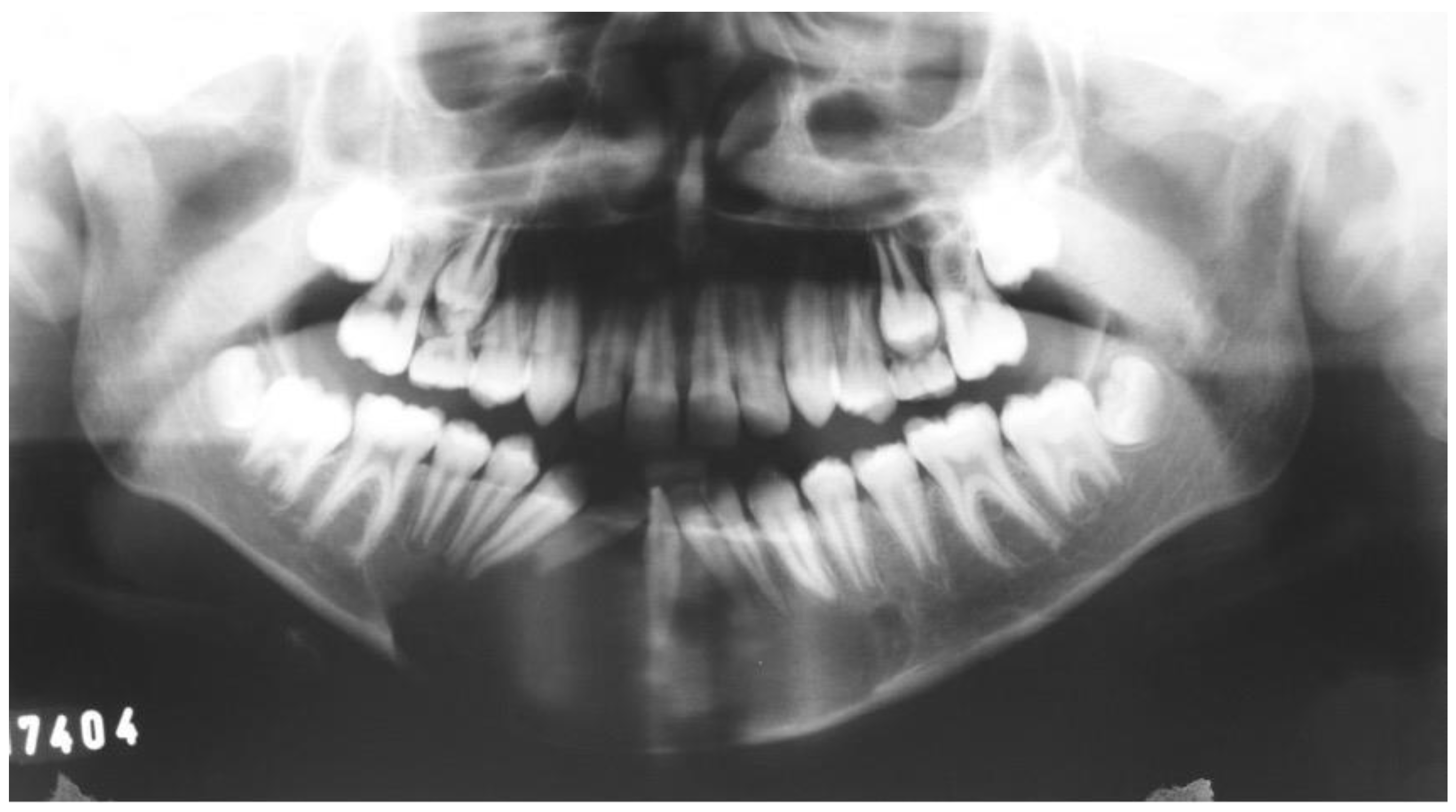 Dentistry 12 00192 g014