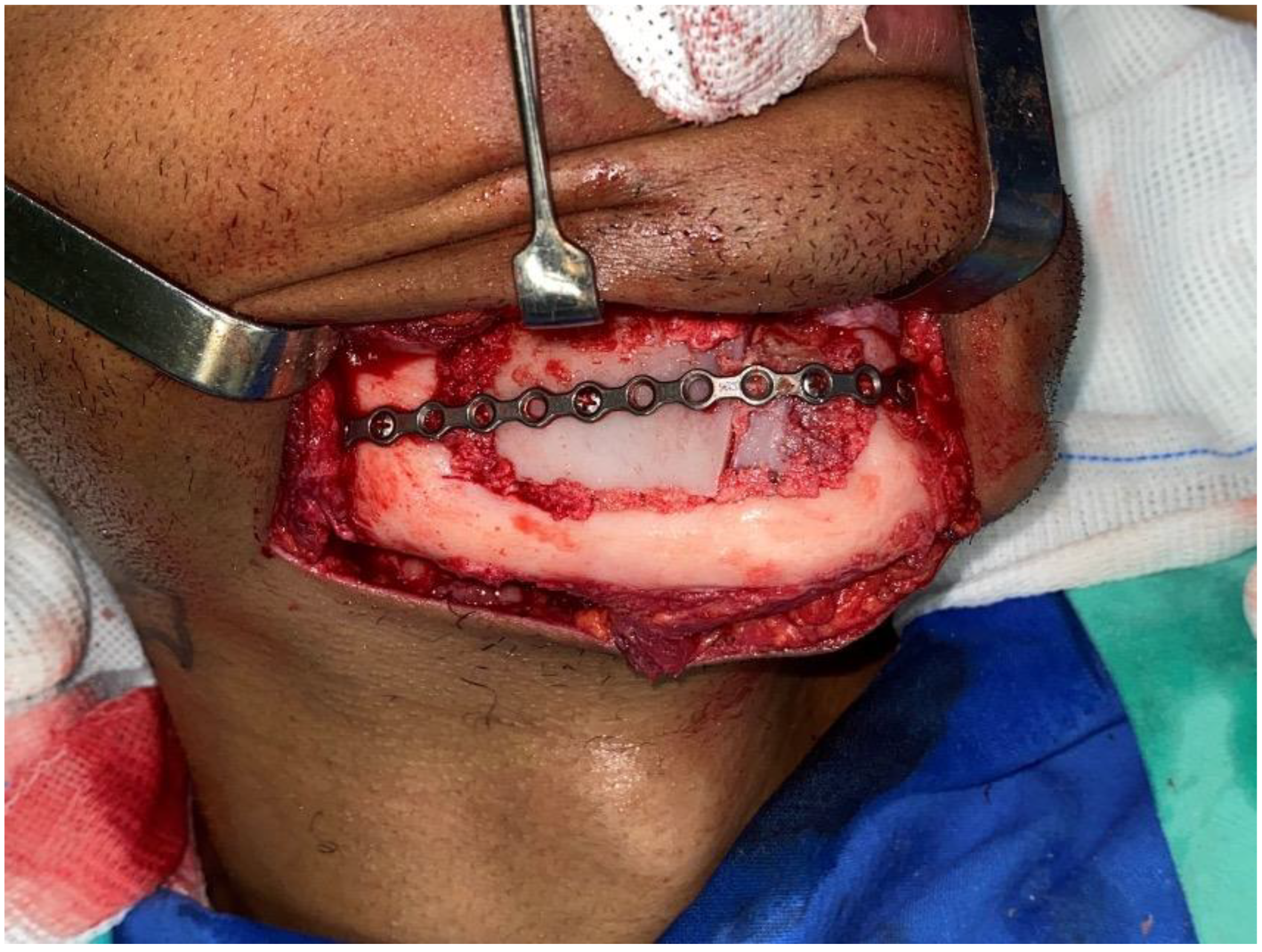 Dentistry 12 00192 g016