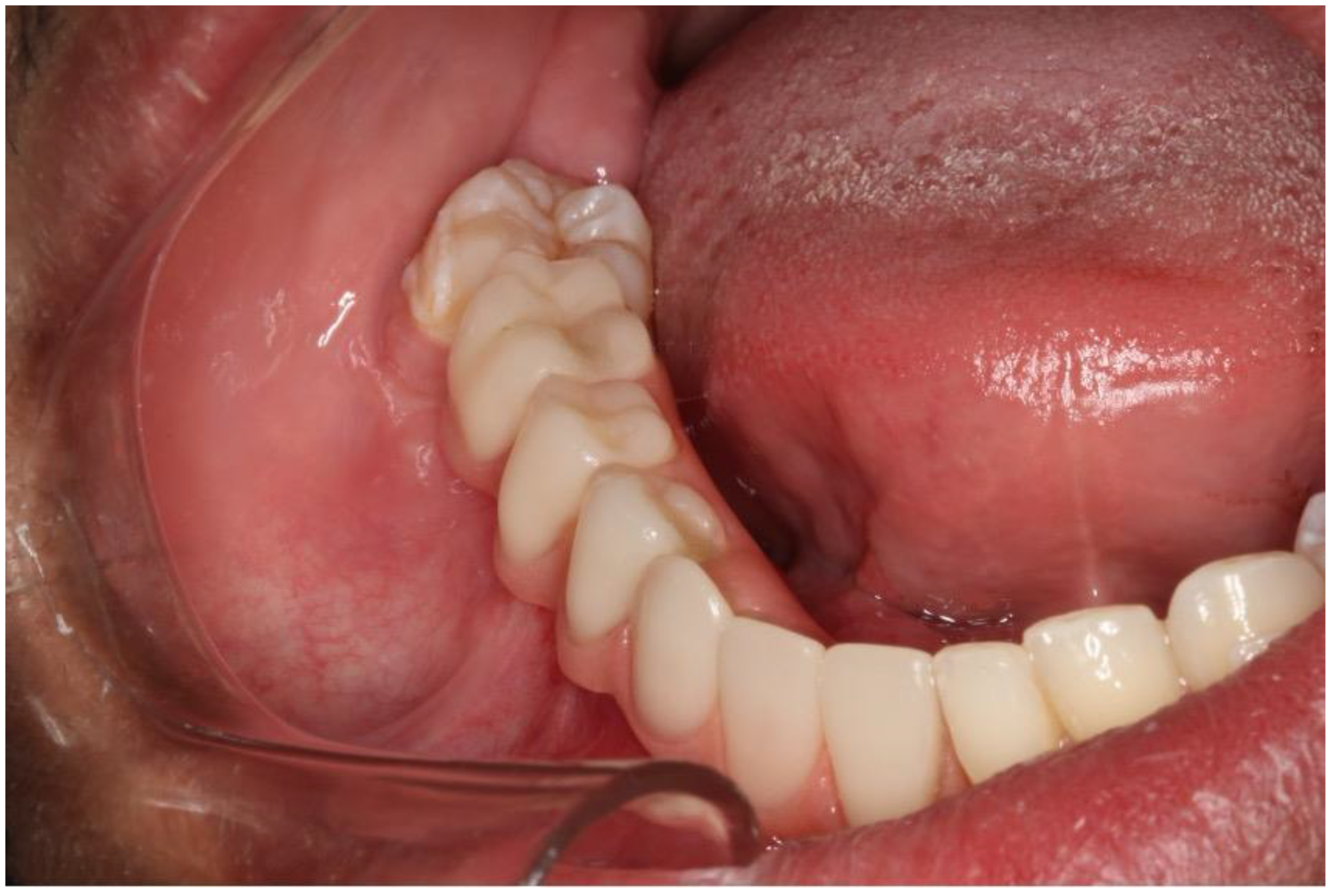 Dentistry 12 00192 g020