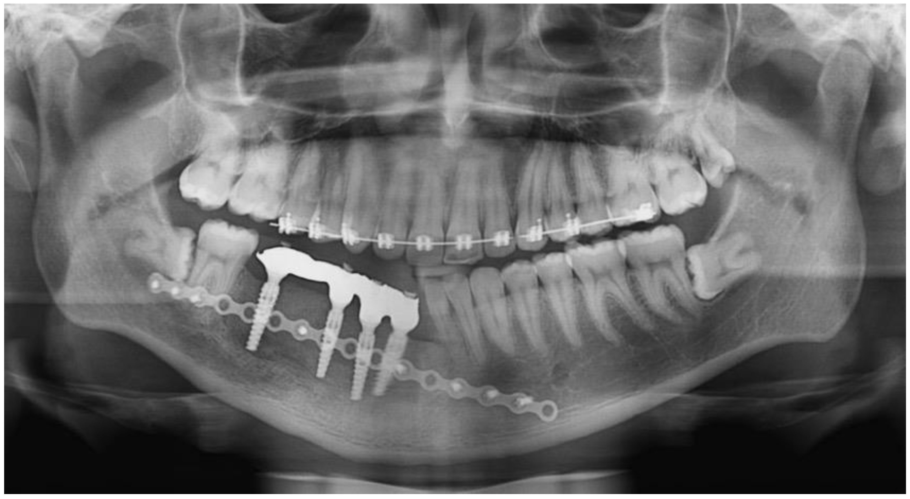 Dentistry 12 00192 g021