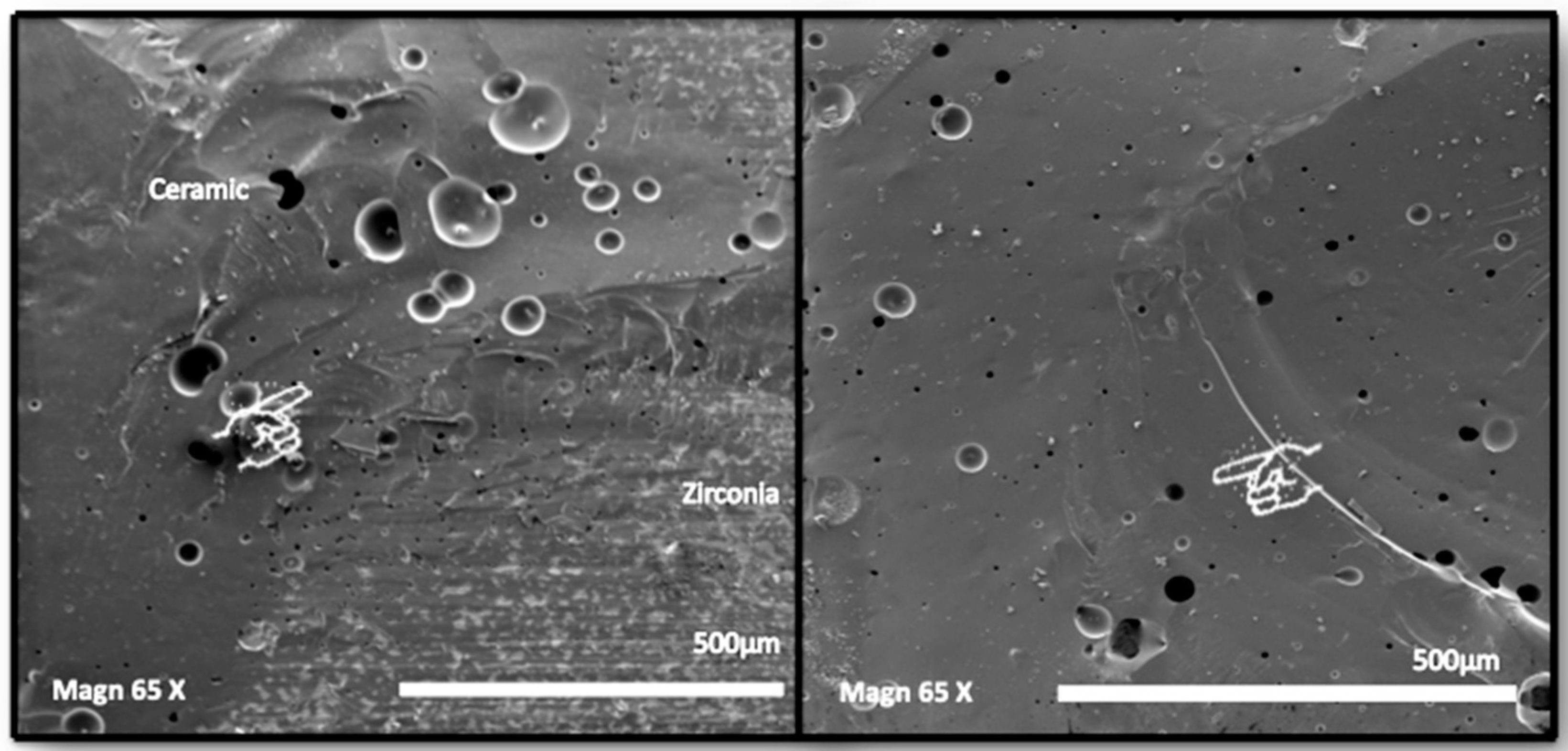 Dentistry 12 00219 g006 Dentistry 12 00219 g006