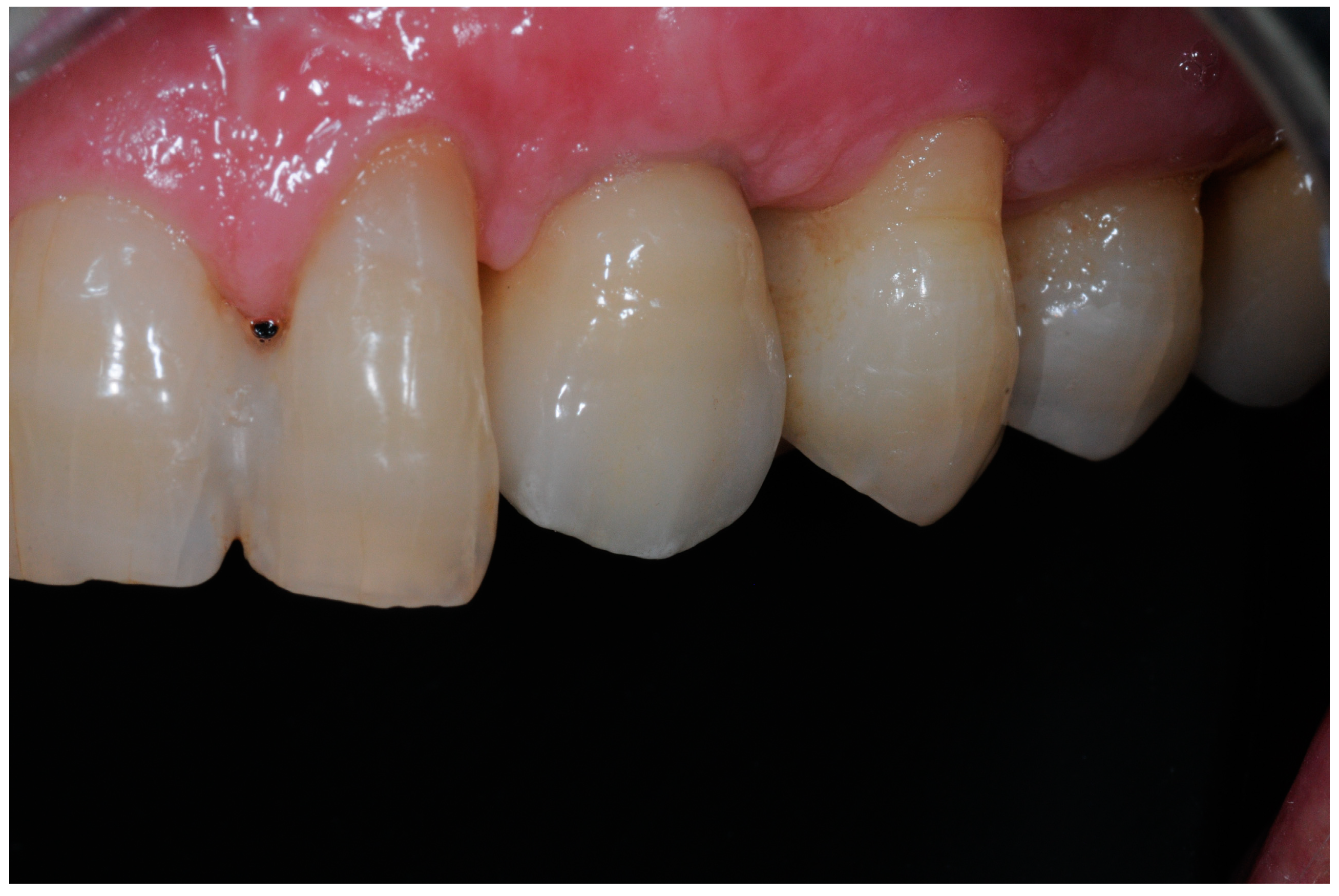 Dentistry 12 00233 g006