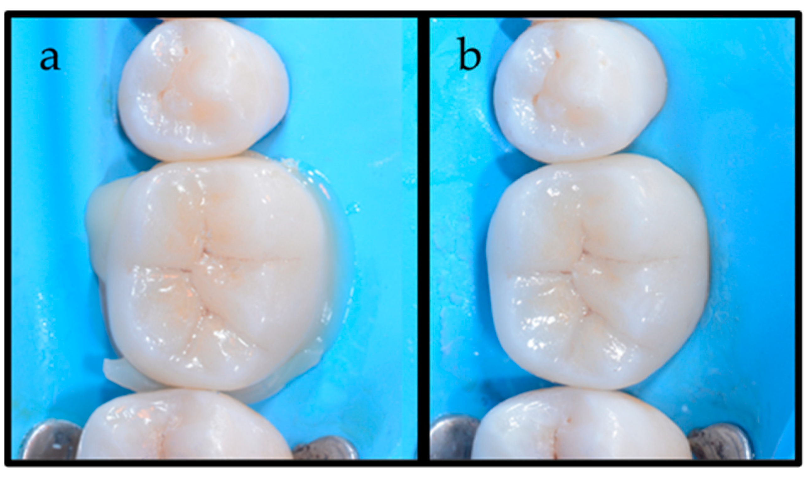 Dentistry 12 00239 g006