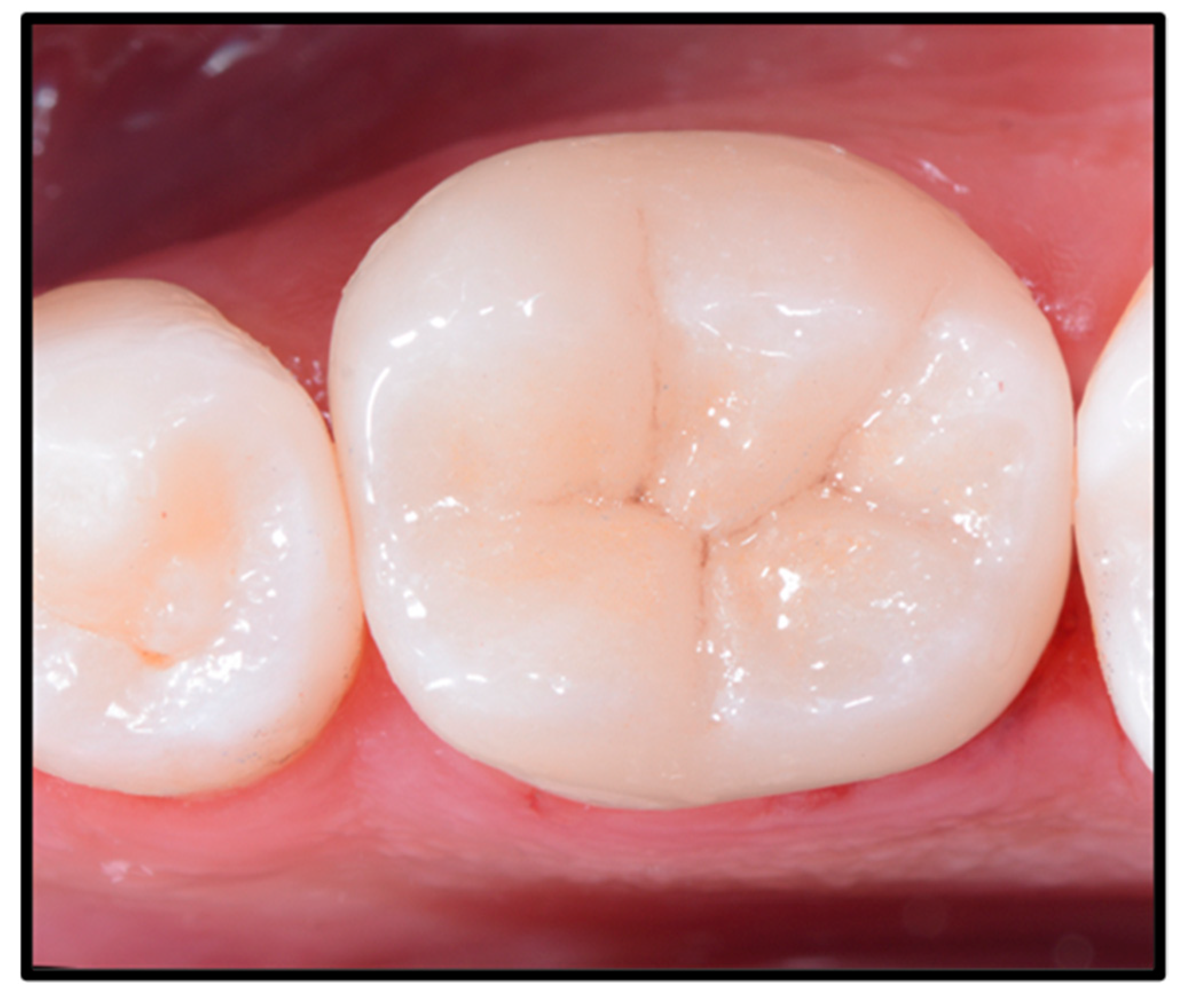 Dentistry 12 00239 g007