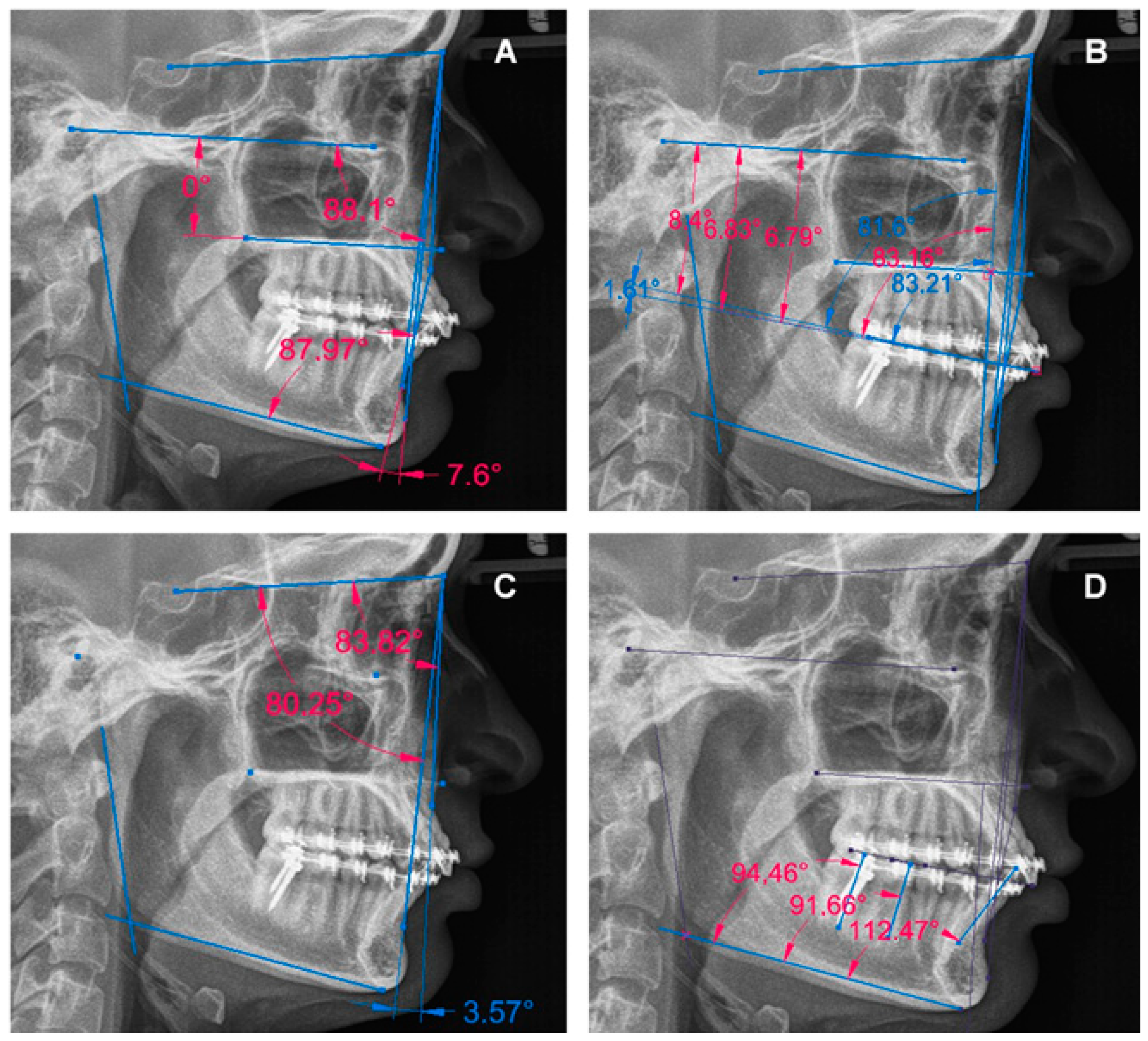 Dentistry 12 00278 g002 Dentistry 12 00278 g002
