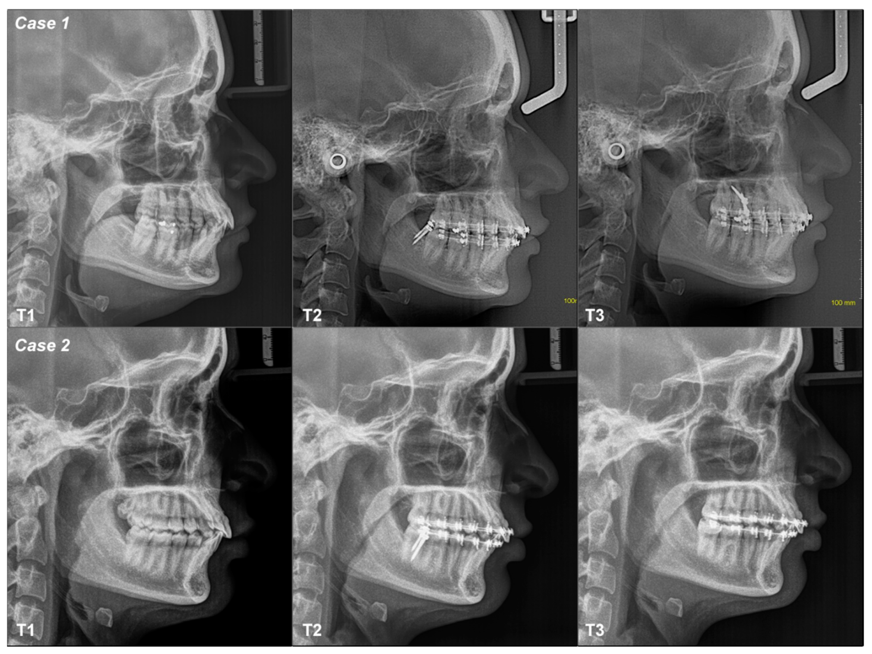 Dentistry 12 00278 g005 Dentistry 12 00278 g005