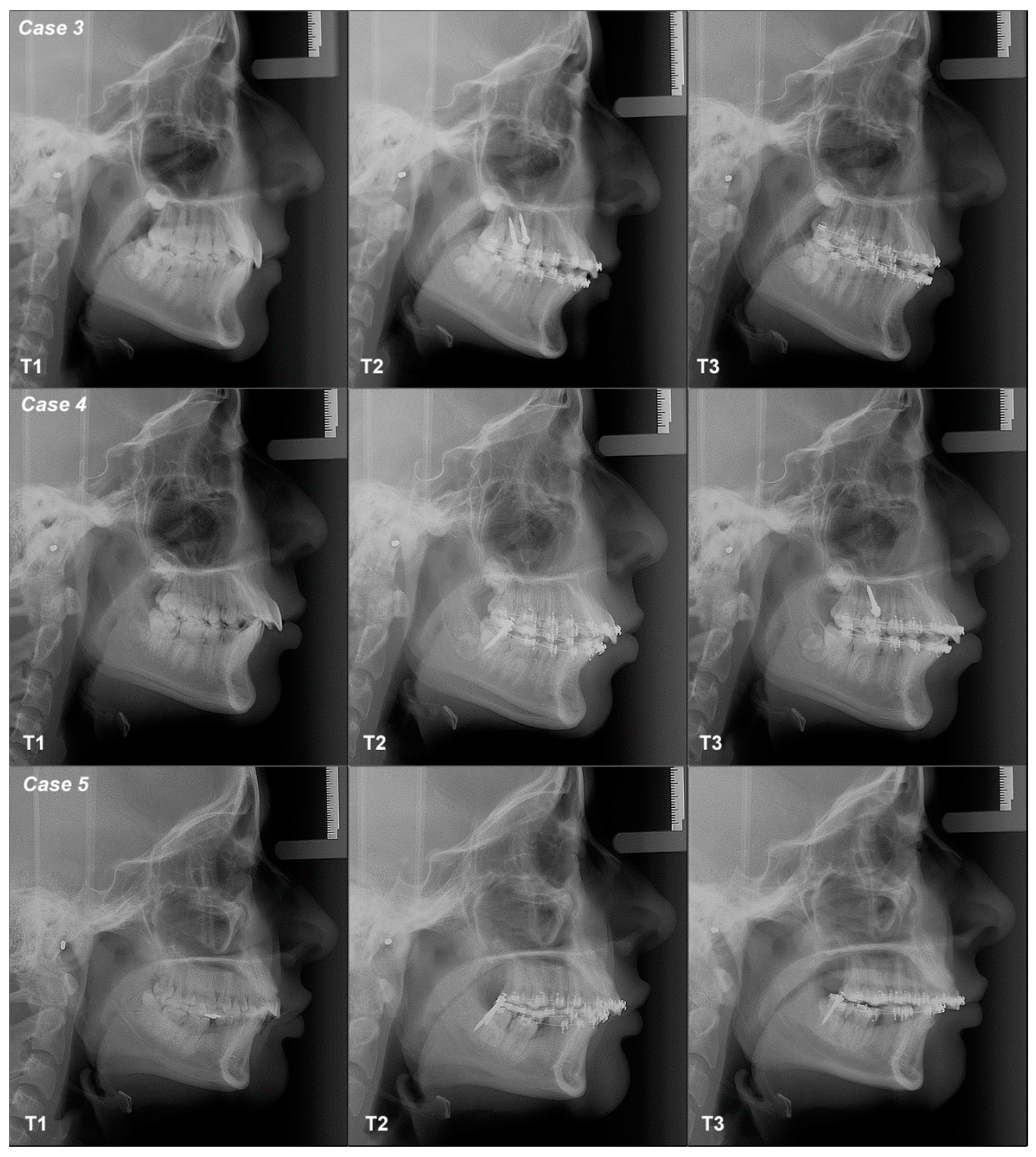 Dentistry 12 00278 g006 Dentistry 12 00278 g006