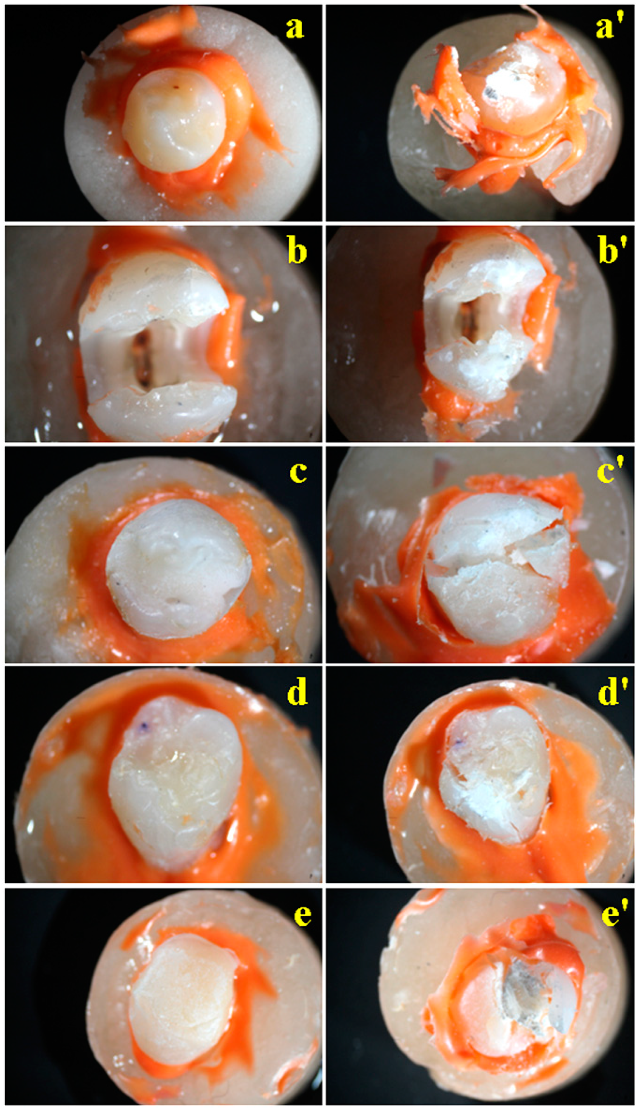 Dentistry 12 00294 g004